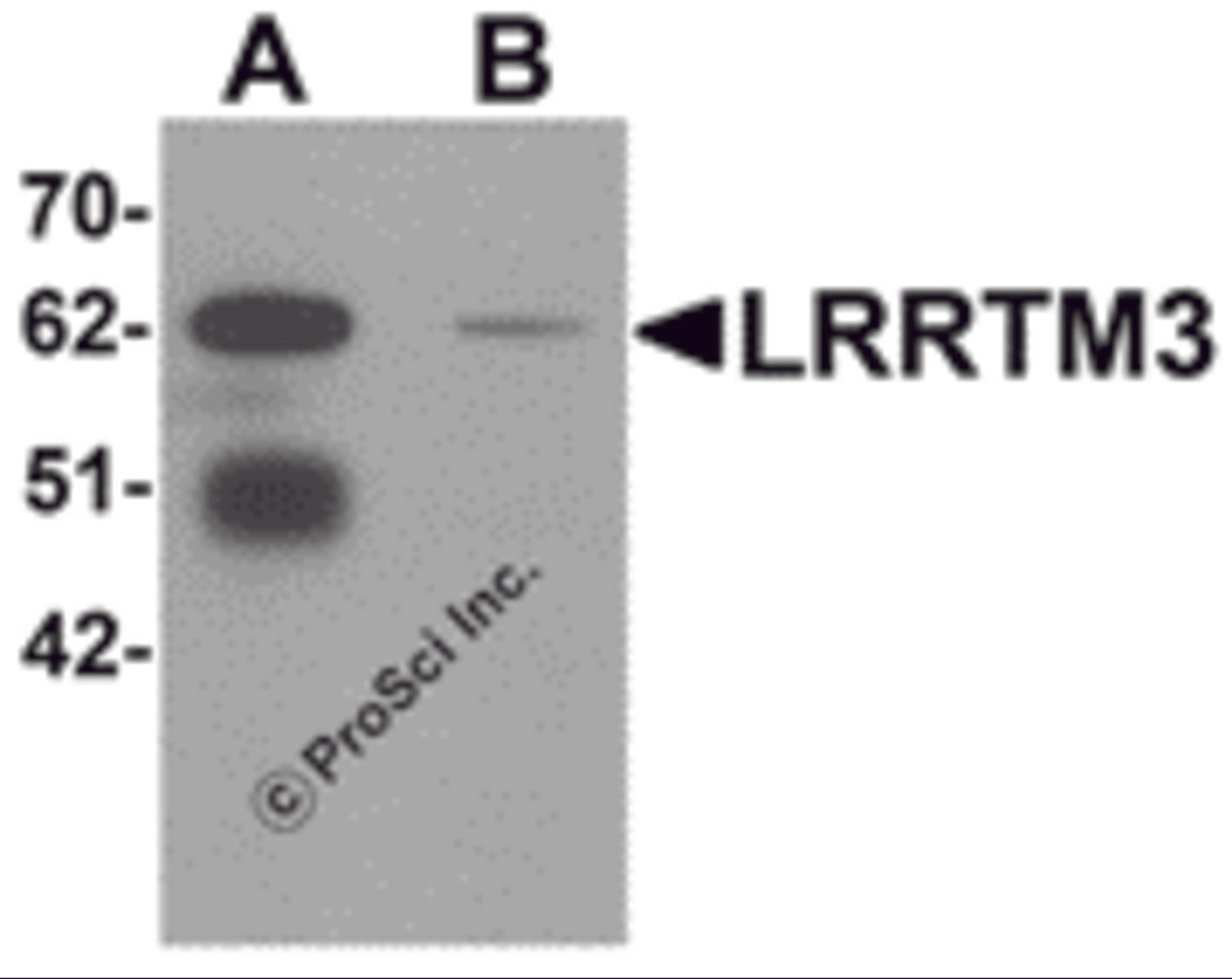 Western blot analysis of LRRTM3 in mouse brain tissue lysate with LRRTM3 antibody at 0.5 μg/mL in (A) the absence and (B) the presence of blocking peptide.