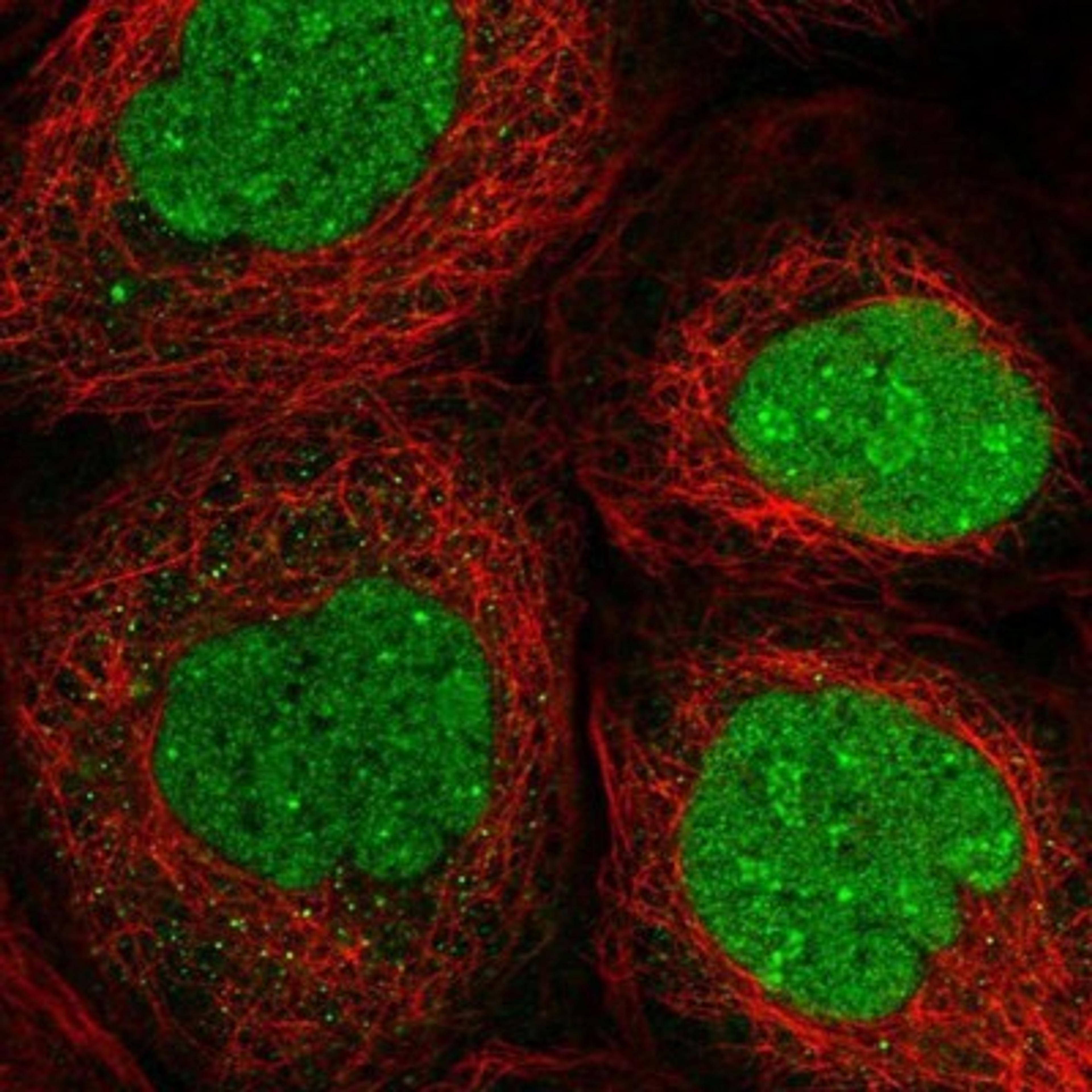 Immunocytochemistry/Immunofluorescence: GNL3L Antibody [NBP1-84618] - Staining of human cell line A-431 shows positivity in nucleus & nucleoli.