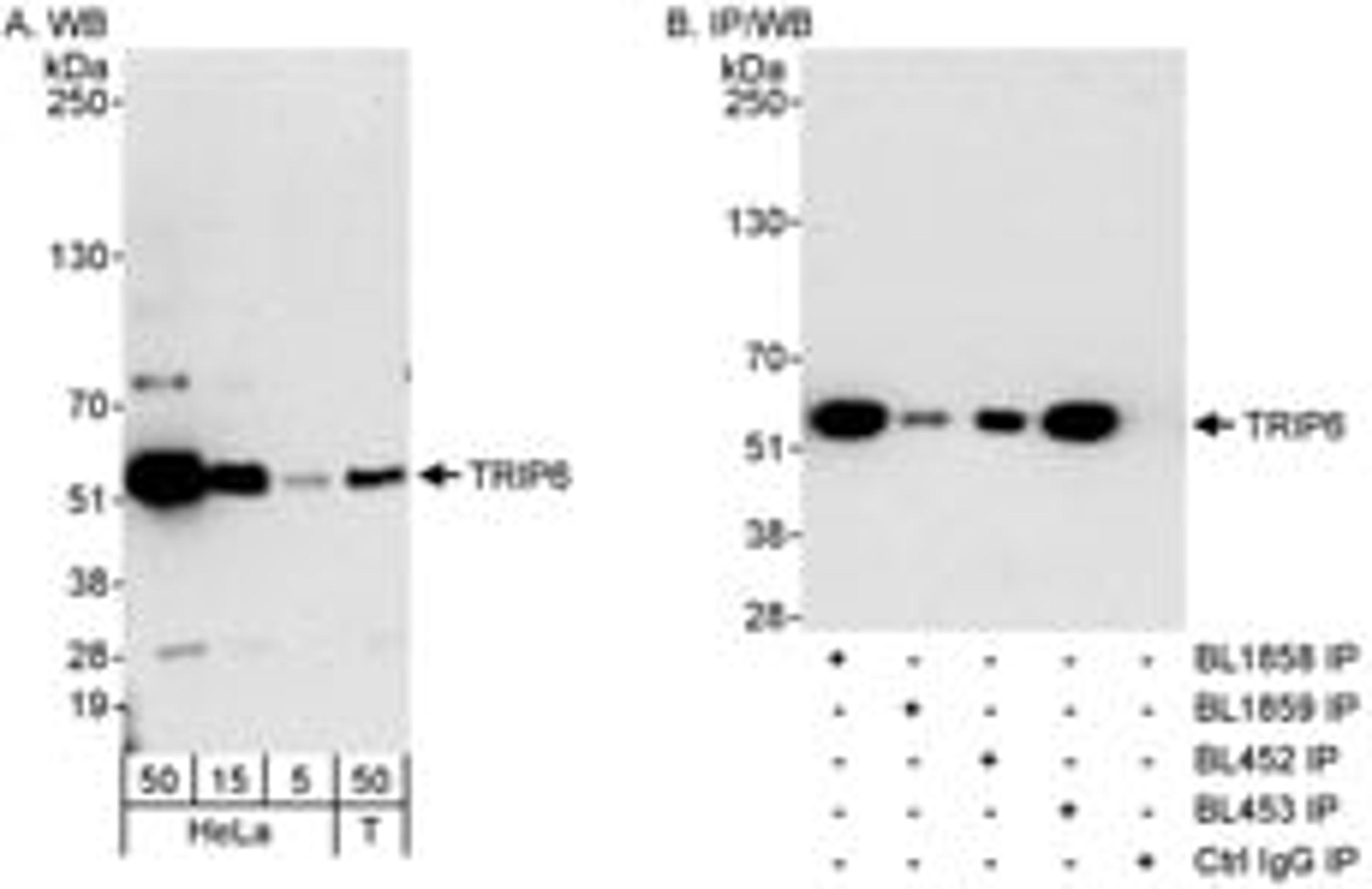 Detection of human TRIP6 by western blot and immunoprecipitation.