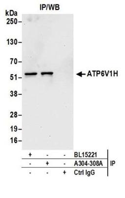 Detection of human ATP6V1H by western blot of immunoprecipitates.