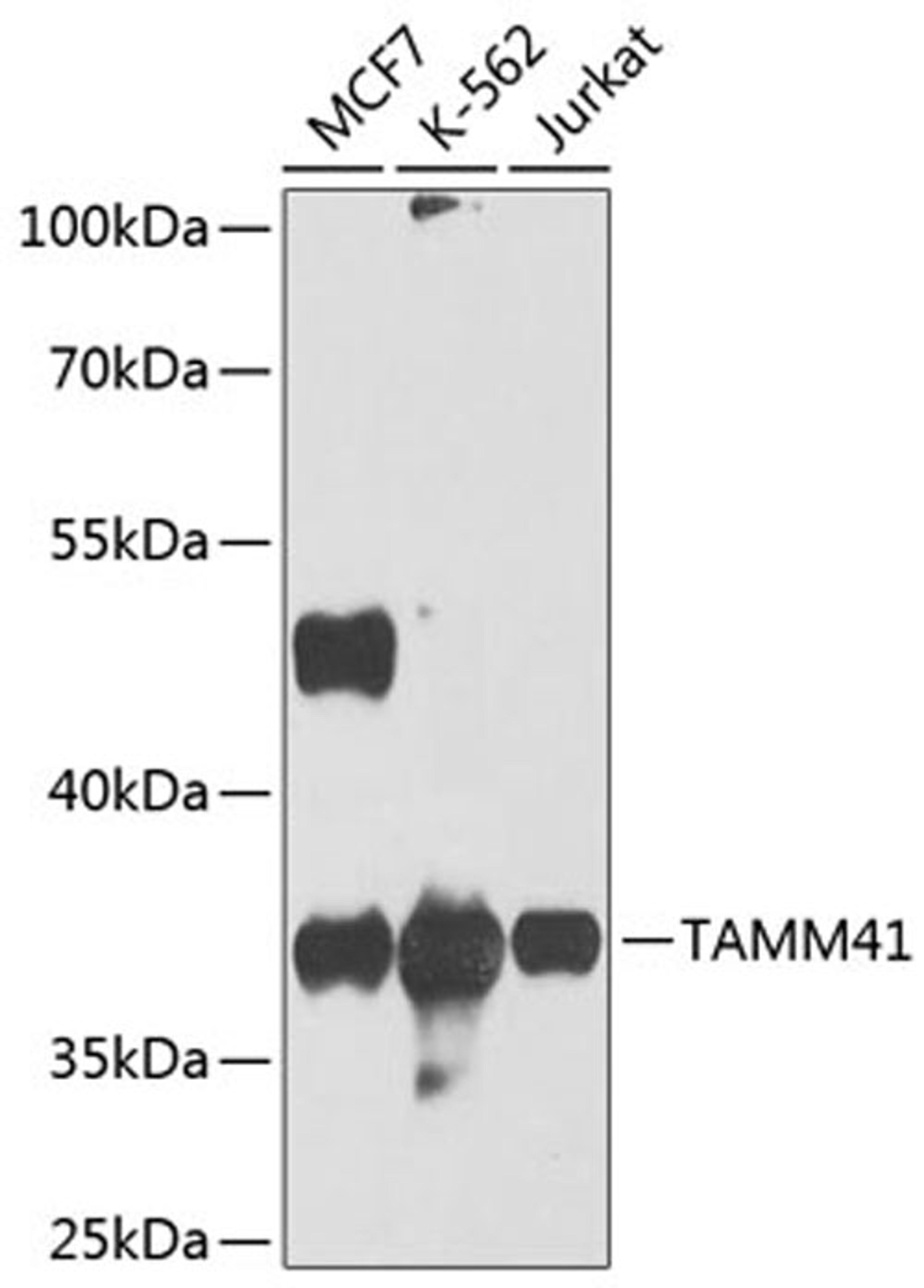 Western blot - TAMM41 antibody (A8374)