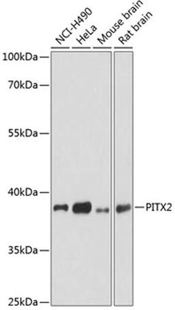 Western blot - PITX2 antibody (A1870)