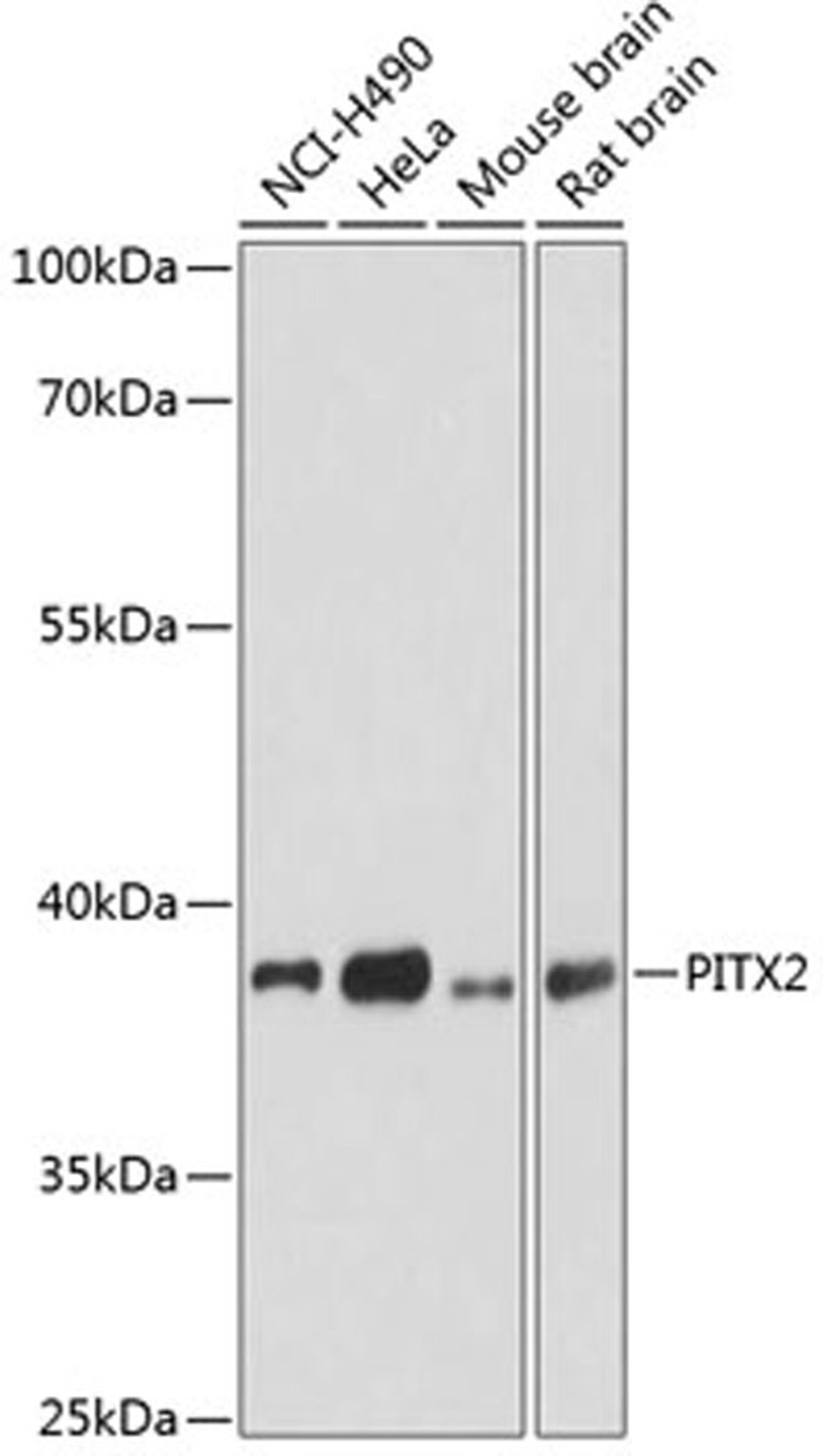 Western blot - PITX2 antibody (A1870)