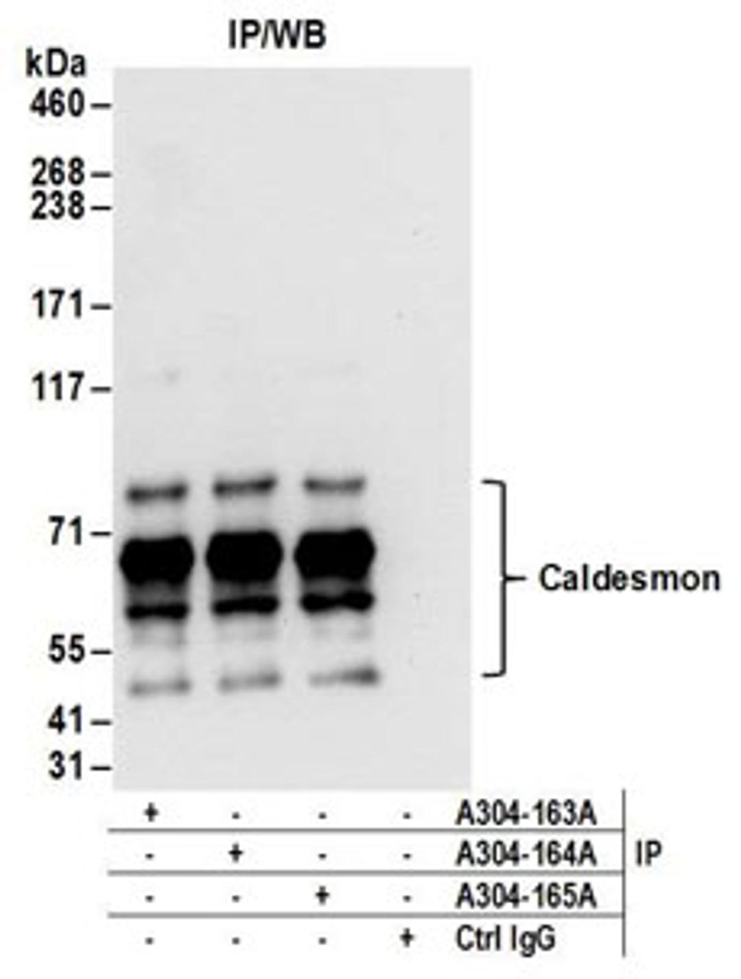 Detection of human Caldesmon by western blot of immunoprecipitates.