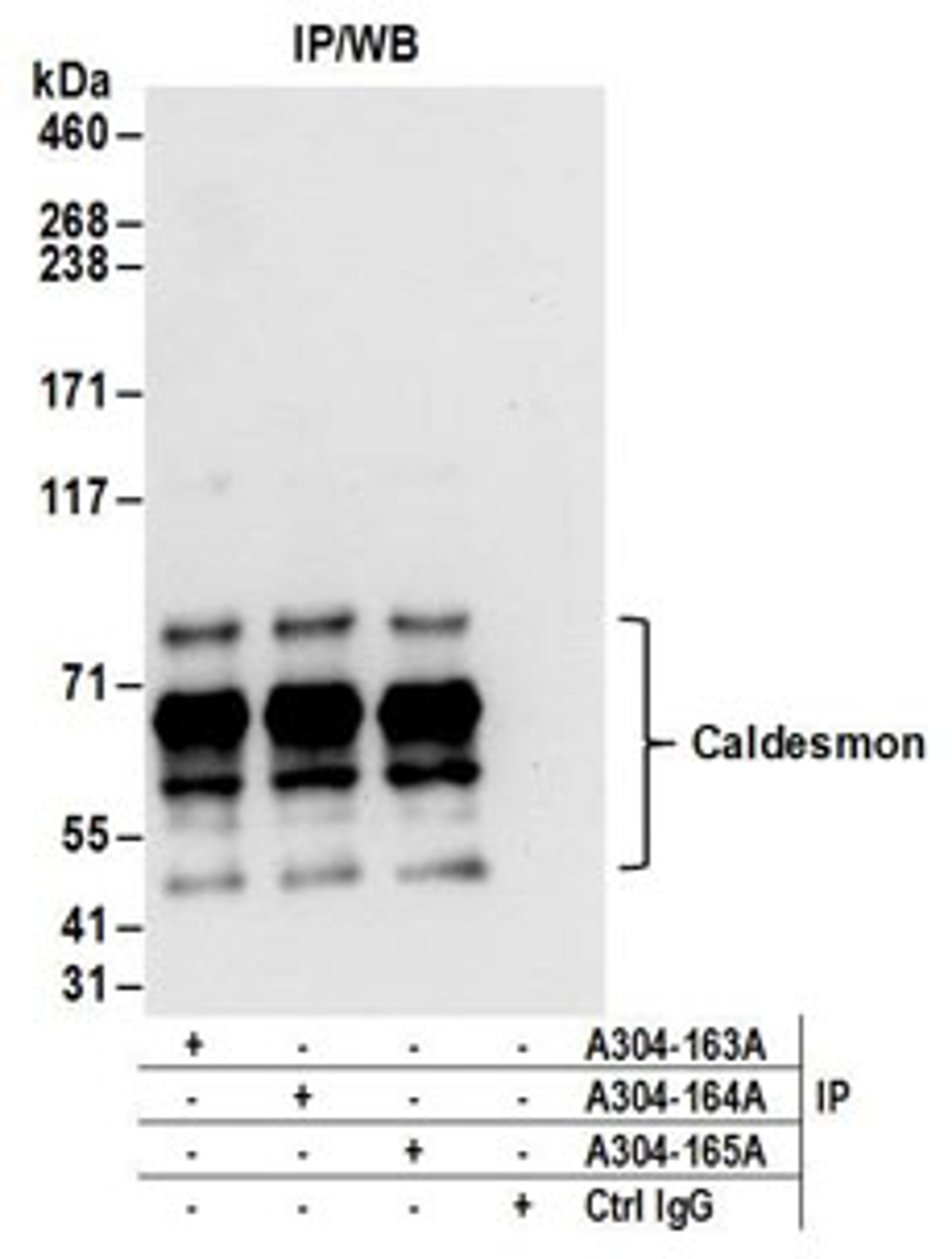 Detection of human Caldesmon by western blot of immunoprecipitates.