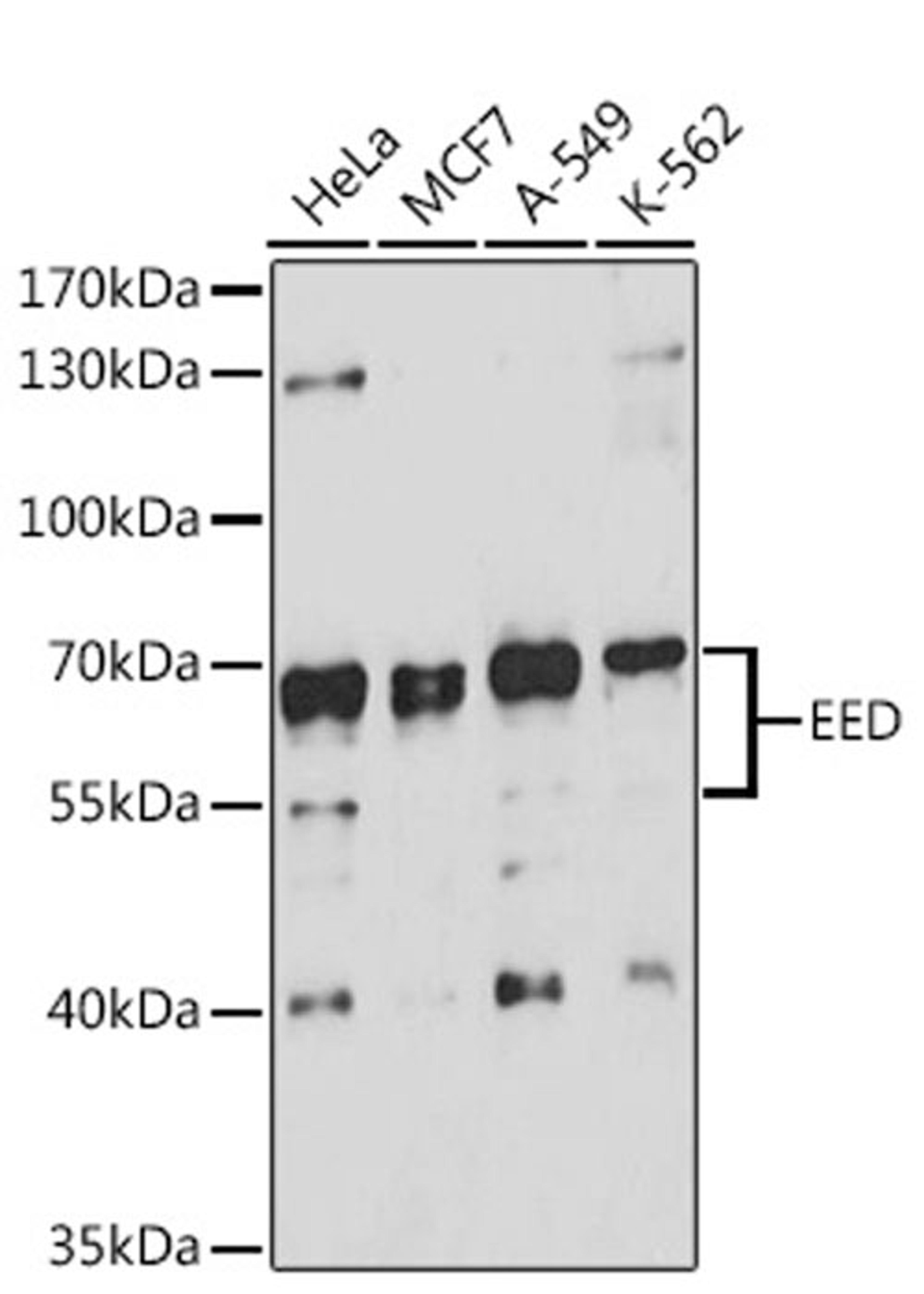 Western blot - EED antibody (A12773)