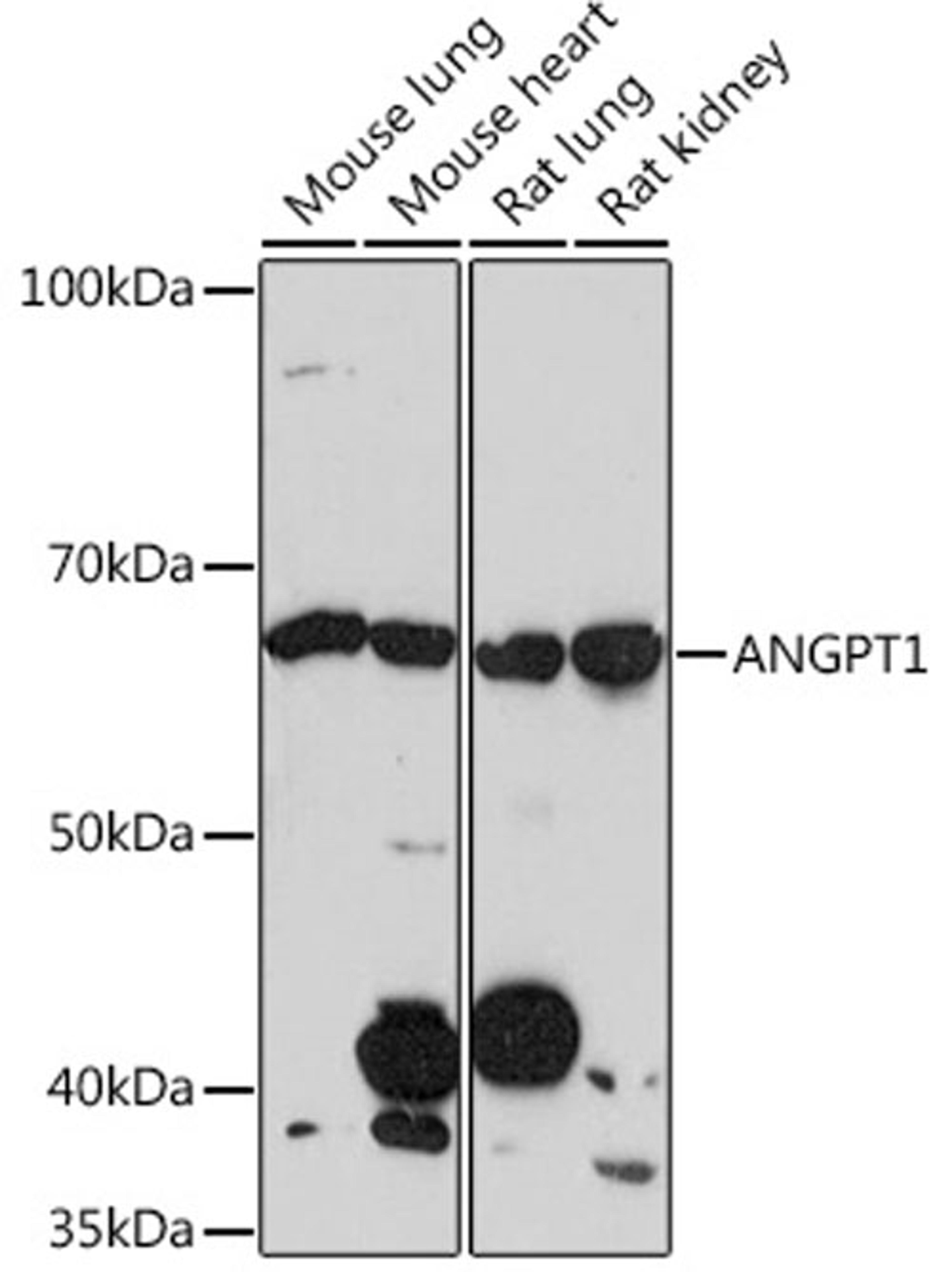 Western blot - ANGPT1 Rabbit mAb (A3757)