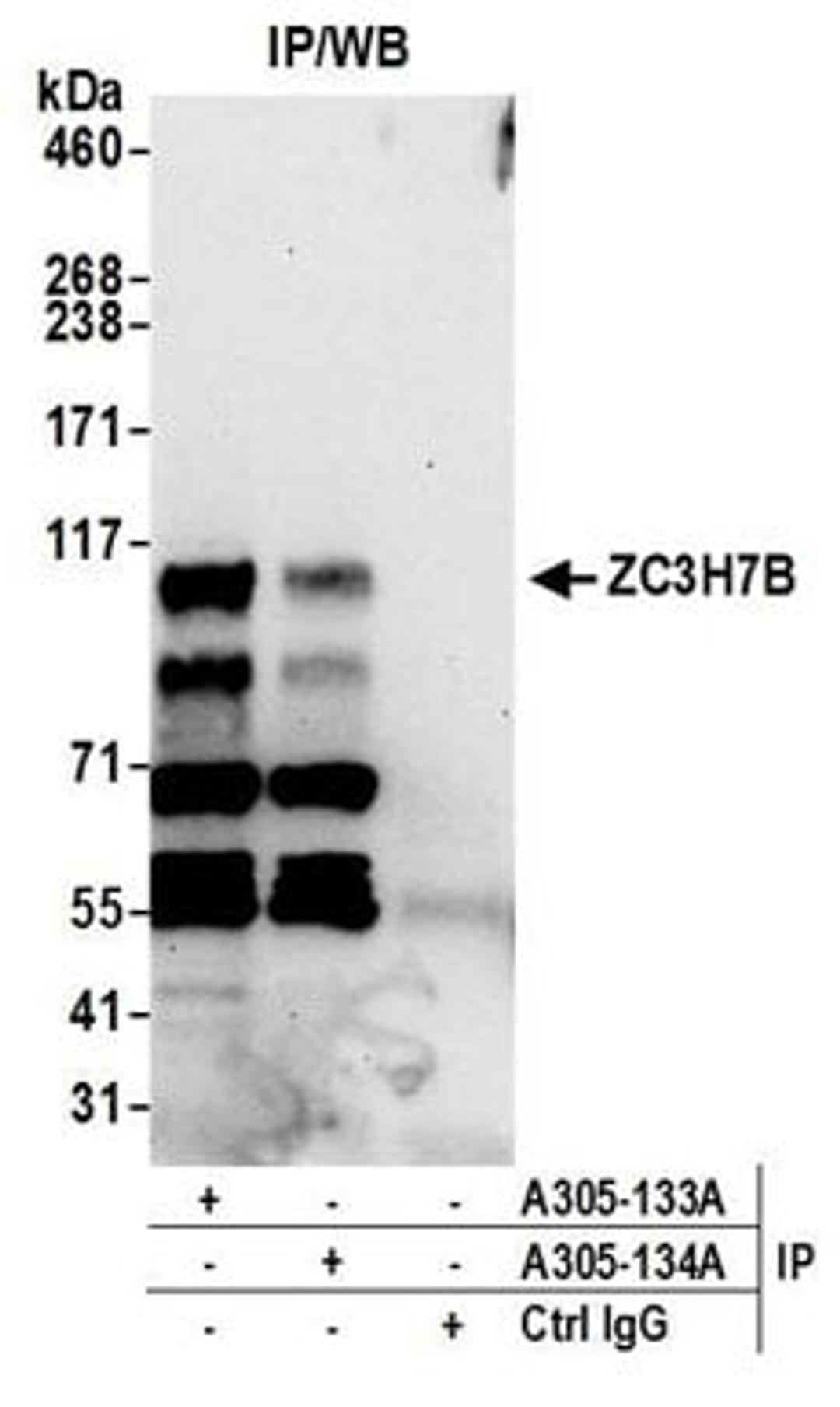 Detection of human ZC3H7B by western blot of immunoprecipitates.