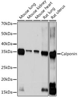 Western blot - Calponin Rabbit mAb (A3734)