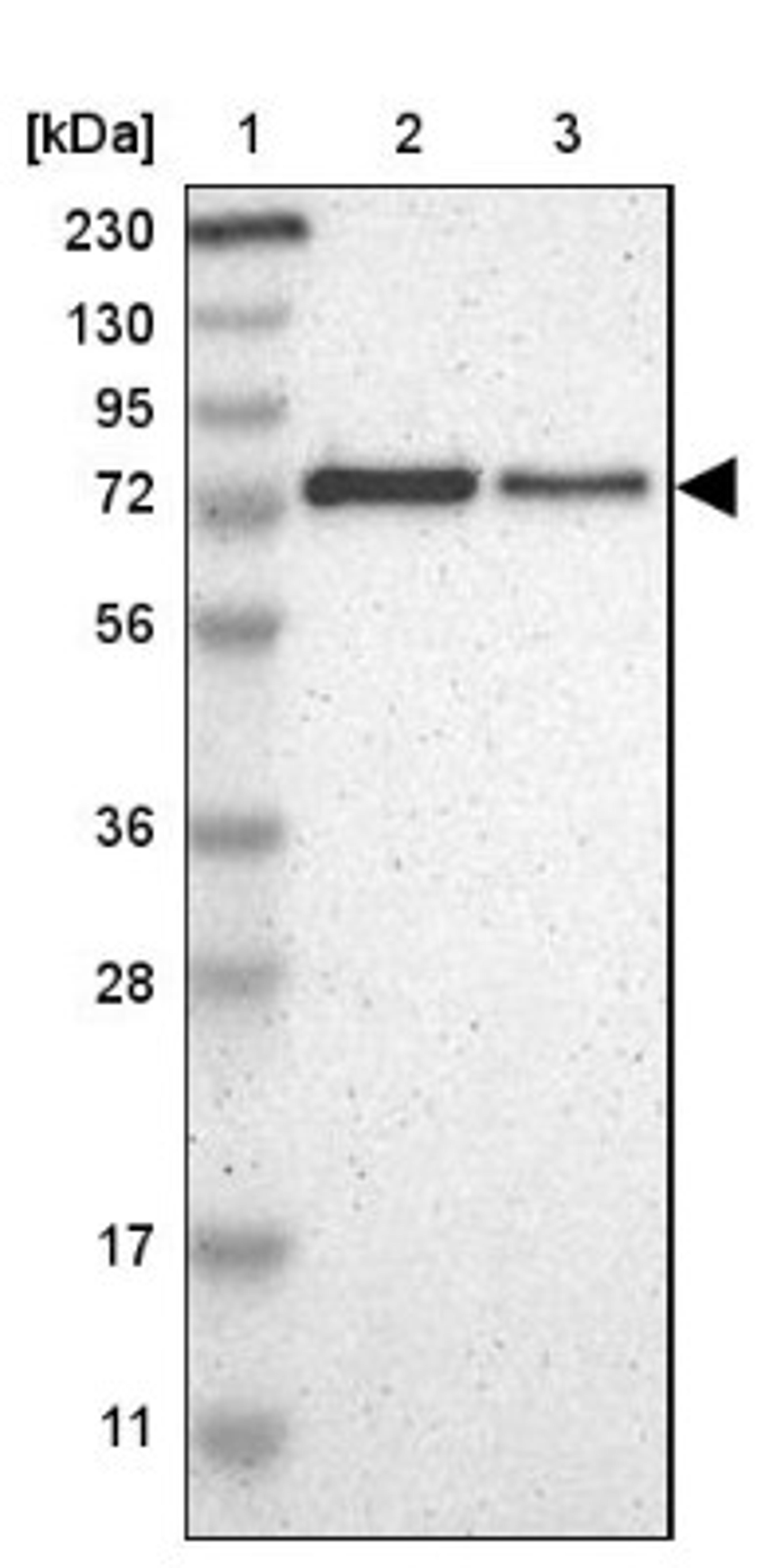 Western Blot: ThPok Antibody [NBP1-88077] - Lane 1: Marker [kDa] 230, 130, 95, 72, 56, 36, 28, 17, 11<br/>Lane 2: Human cell line RT-4<br/>Lane 3: Human cell line U-251MG sp