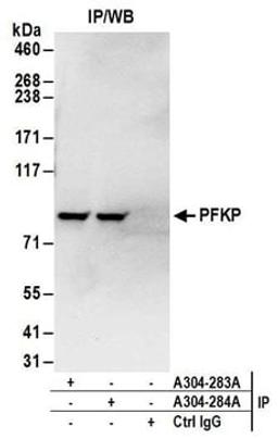 Detection of human PFKP by western blot of immunoprecipitates.