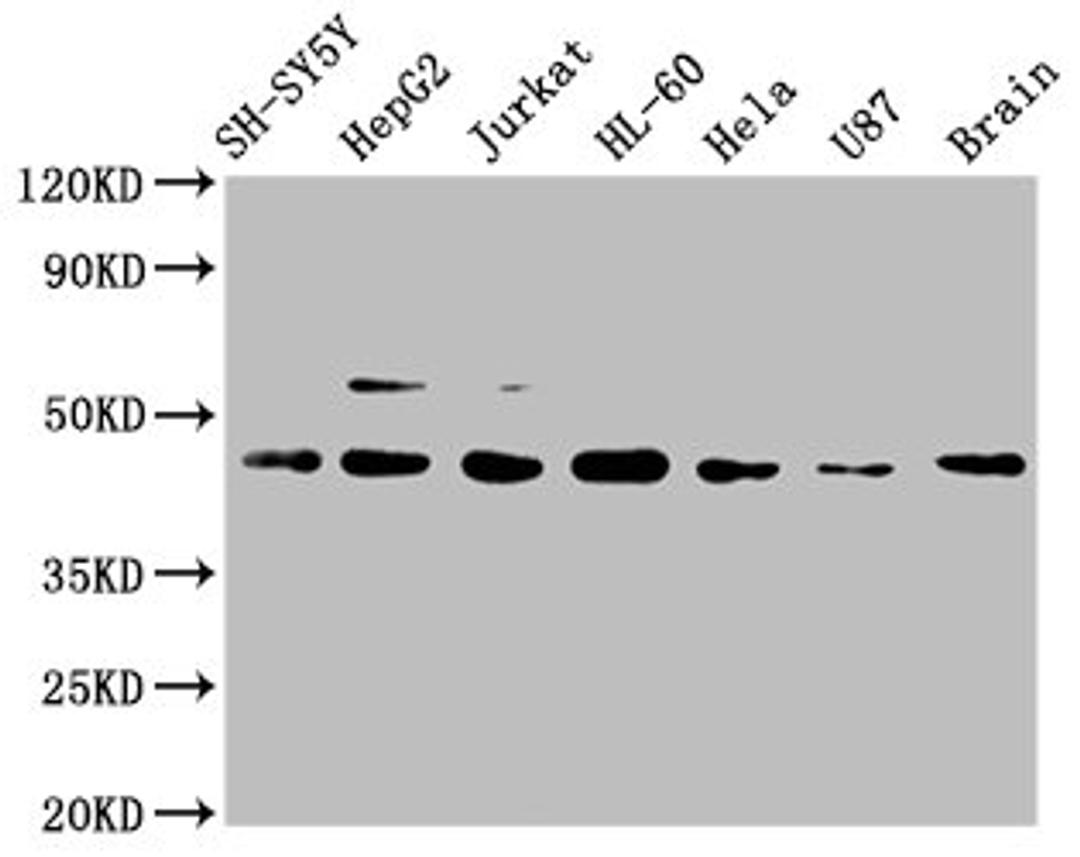 Western Blot. Positive WB detected in: SH-SY5Y whole cell lysate, HepG2 whole cell lysate, Jurkat whole cell lysate, HL-60 whole cell lysate, Hela whole cell lysate, U87 whole cell lysate, Mouse brain tissue. All lanes: CCR9 antibody at 1μg/ml. Secondary. Goat polyclonal to rabbit IgG at 1/50000 dilution. Predicted band size: 43, 41 KDa. Observed band size: 43 KDa. 