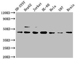 Western Blot. Positive WB detected in: SH-SY5Y whole cell lysate, HepG2 whole cell lysate, Jurkat whole cell lysate, HL-60 whole cell lysate, Hela whole cell lysate, U87 whole cell lysate, Mouse brain tissue. All lanes: CCR9 antibody at 1μg/ml. Secondary. Goat polyclonal to rabbit IgG at 1/50000 dilution. Predicted band size: 43, 41 KDa. Observed band size: 43 KDa. 