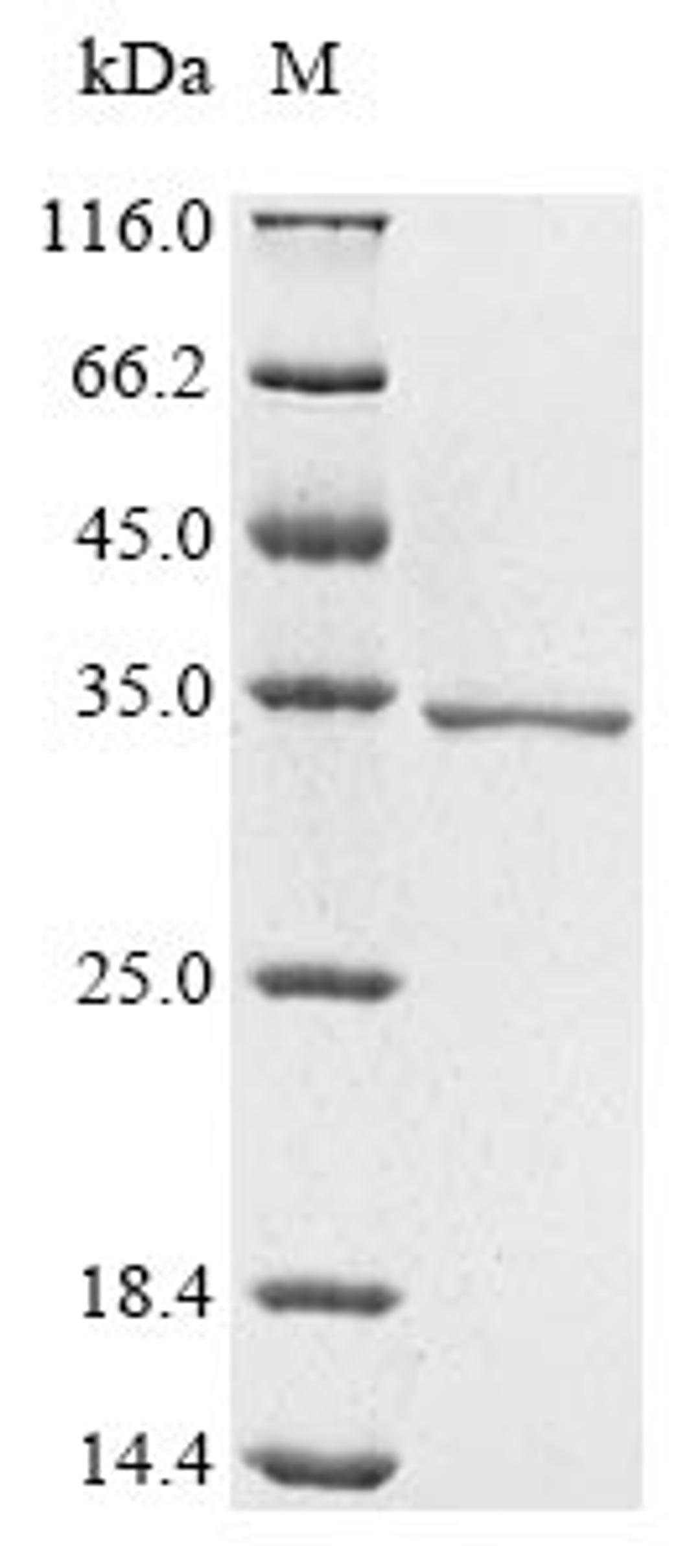(Tris-Glycine gel) Discontinuous SDS-PAGE (reduced) with 5% enrichment gel and 15% separation gel.