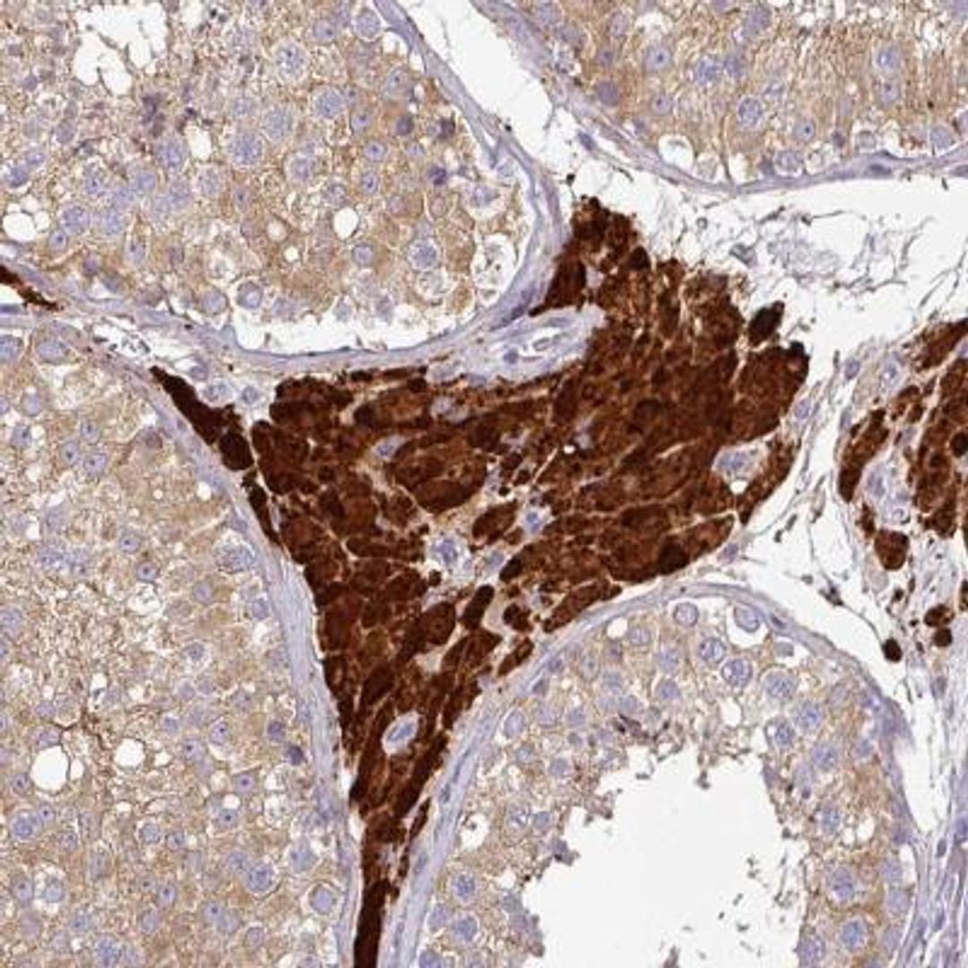 Immunohistochemistry: CD3G Antibody [NBP2-32636] - Immunohistochemical staining of human testis shows strong cytoplasmic positivity in Leydig cells.