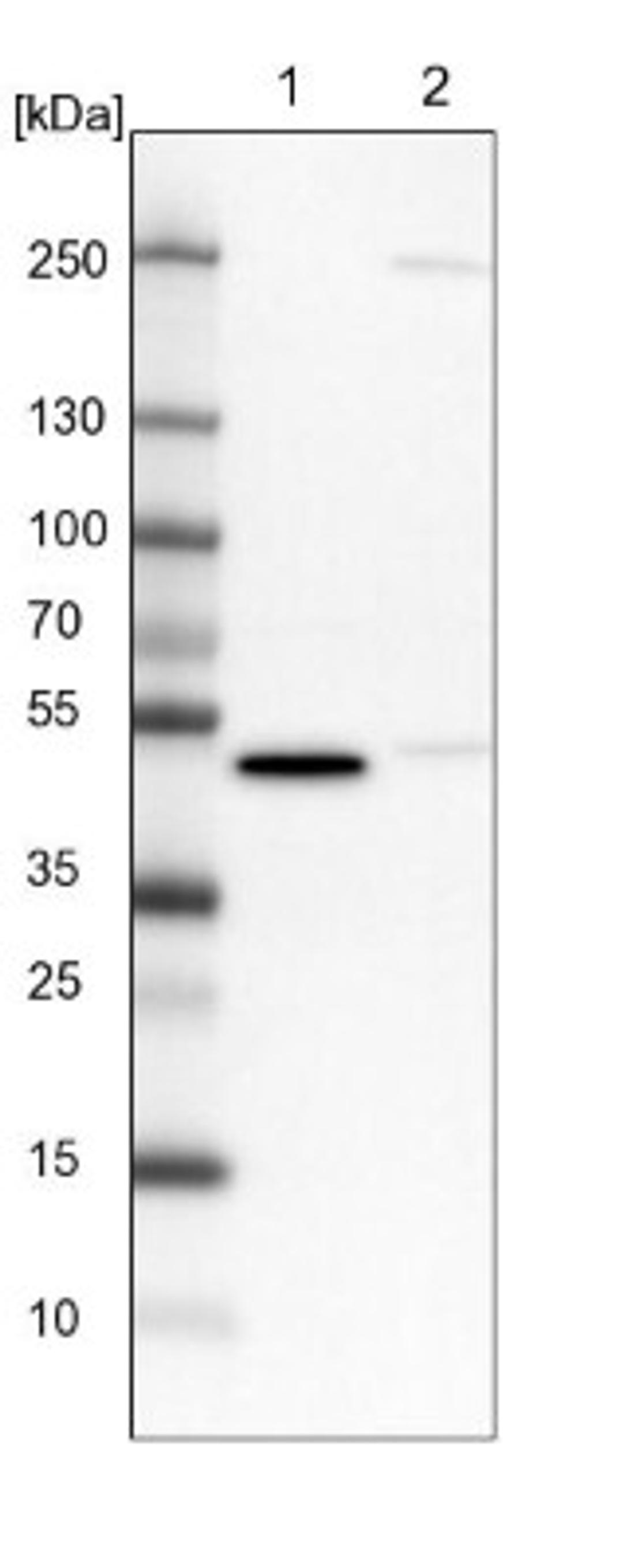 Western Blot: CRTAP Antibody [NBP1-94105] - Lane 1: NIH-3T3 cell lysate (Mouse embryonic fibroblast cells)<br/>Lane 2: NBT-II cell lysate (Rat Wistar bladder tumour cells)