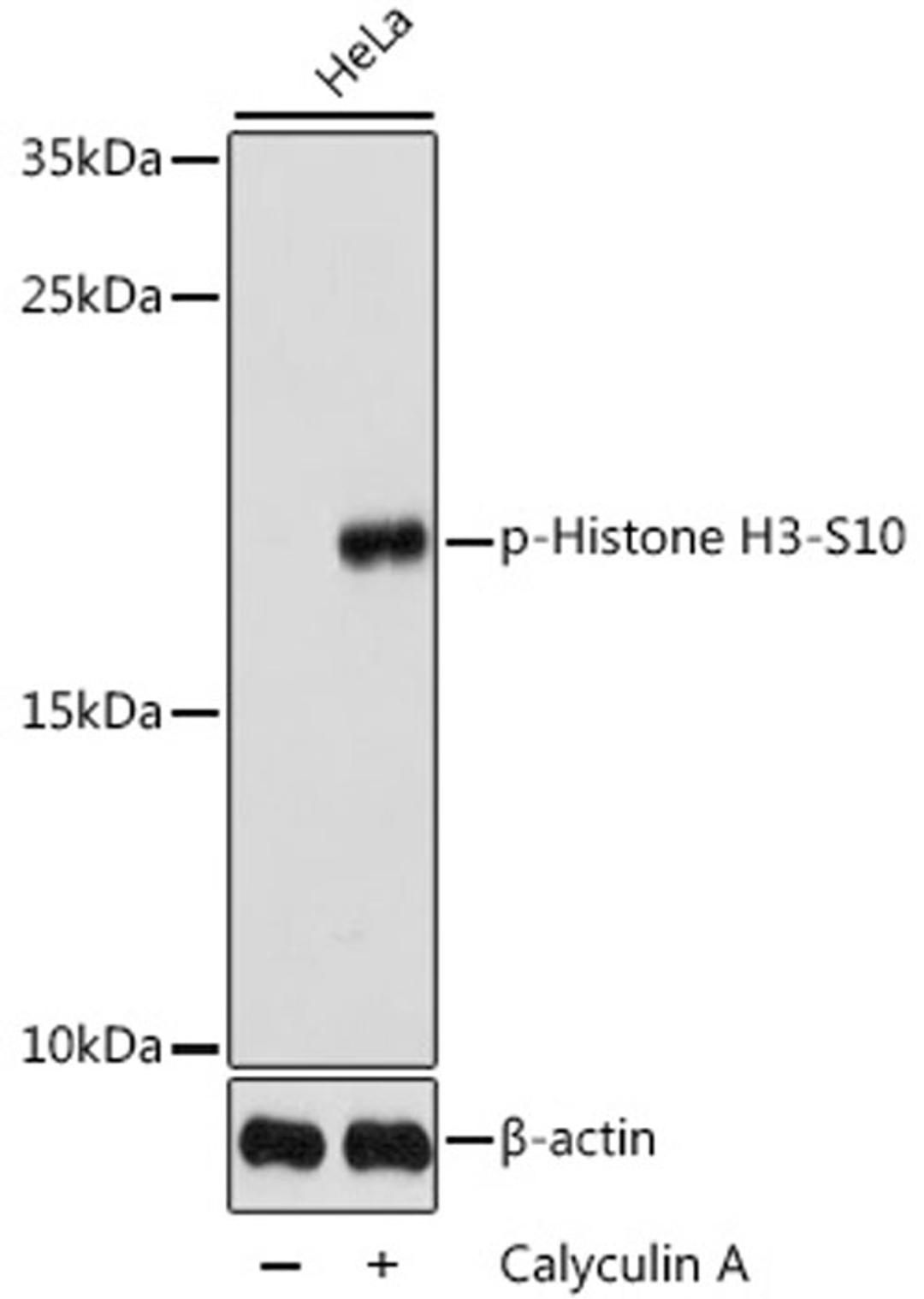 Western blot - Phospho-Histone H3-S10 antibody (AP0840)