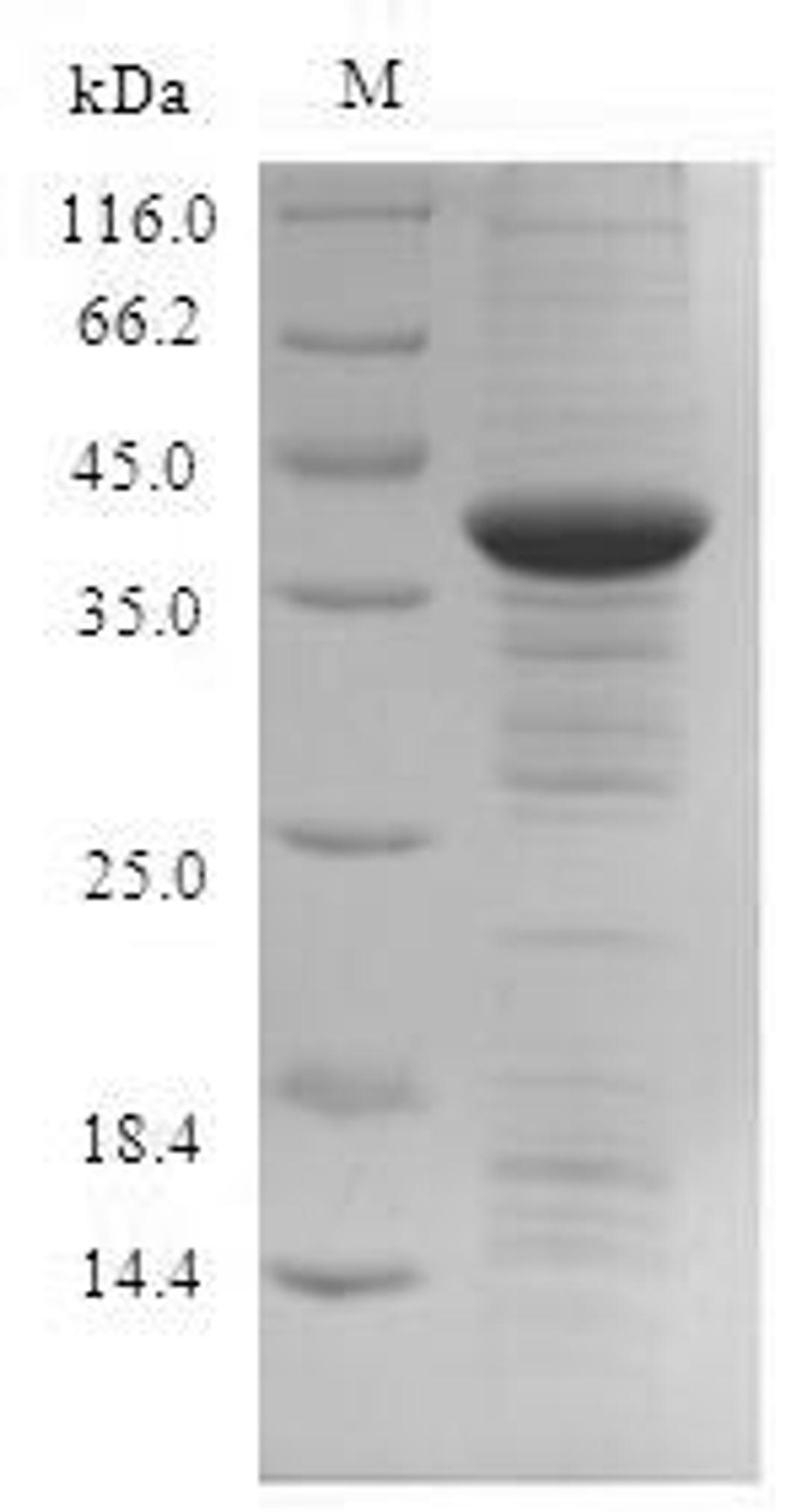 (Tris-Glycine gel) Discontinuous SDS-PAGE (reduced) with 5% enrichment gel and 15% separation gel.