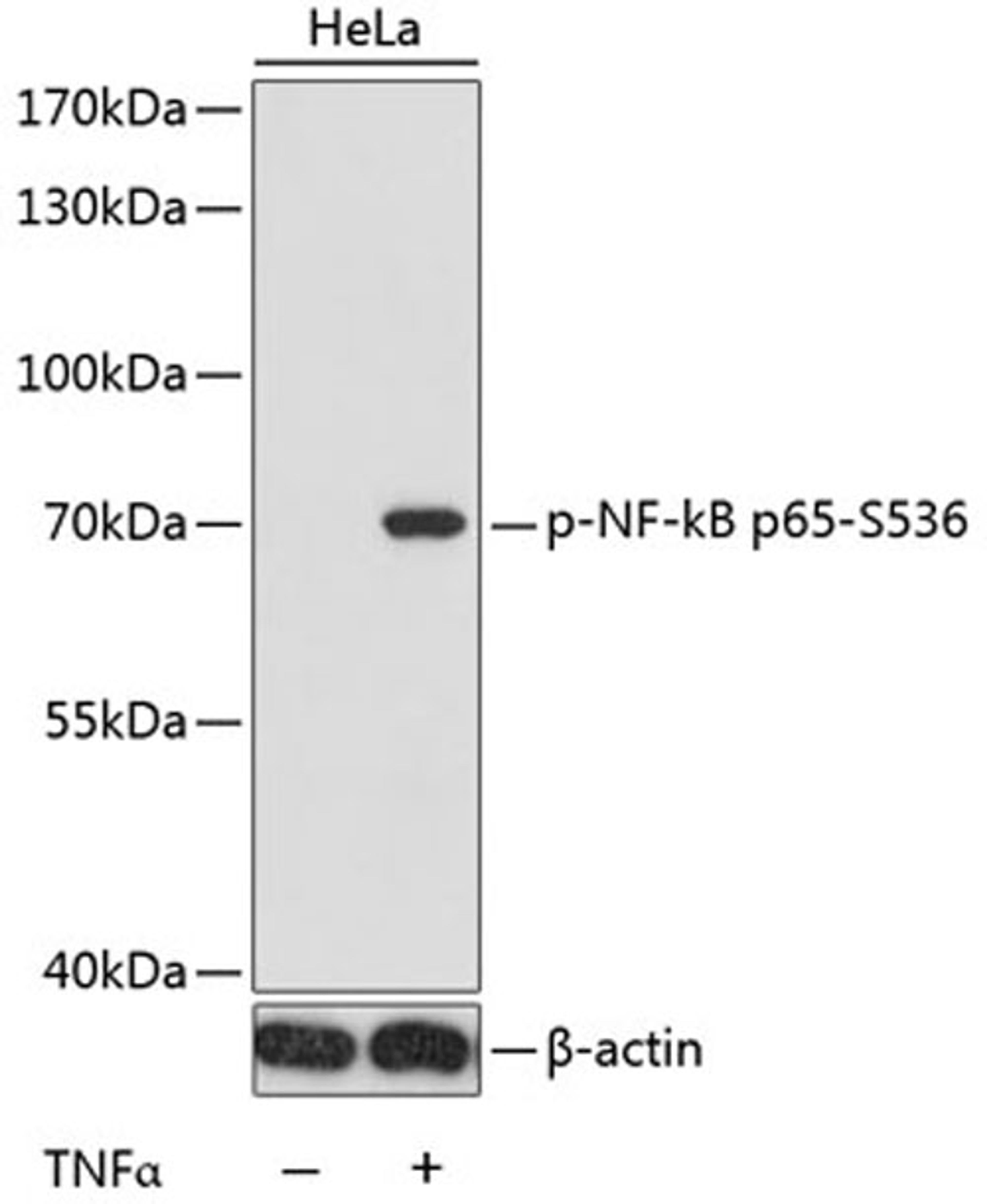 Western blot - Phospho-NF-kB p65-S536 antibody (AP0475)