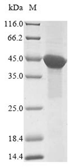 (Tris-Glycine gel) Discontinuous SDS-PAGE (reduced) with 5% enrichment gel and 15% separation gel.