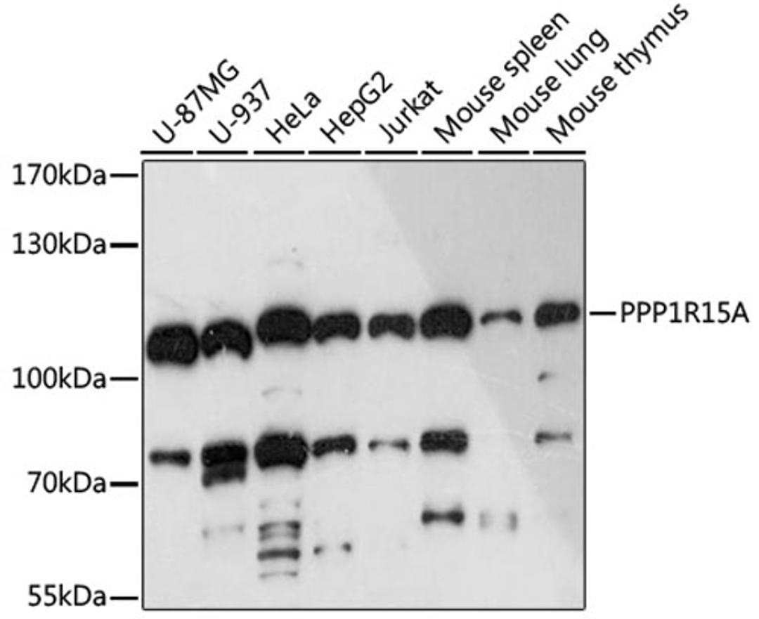 Western blot - PPP1R15A antibody (A16260)