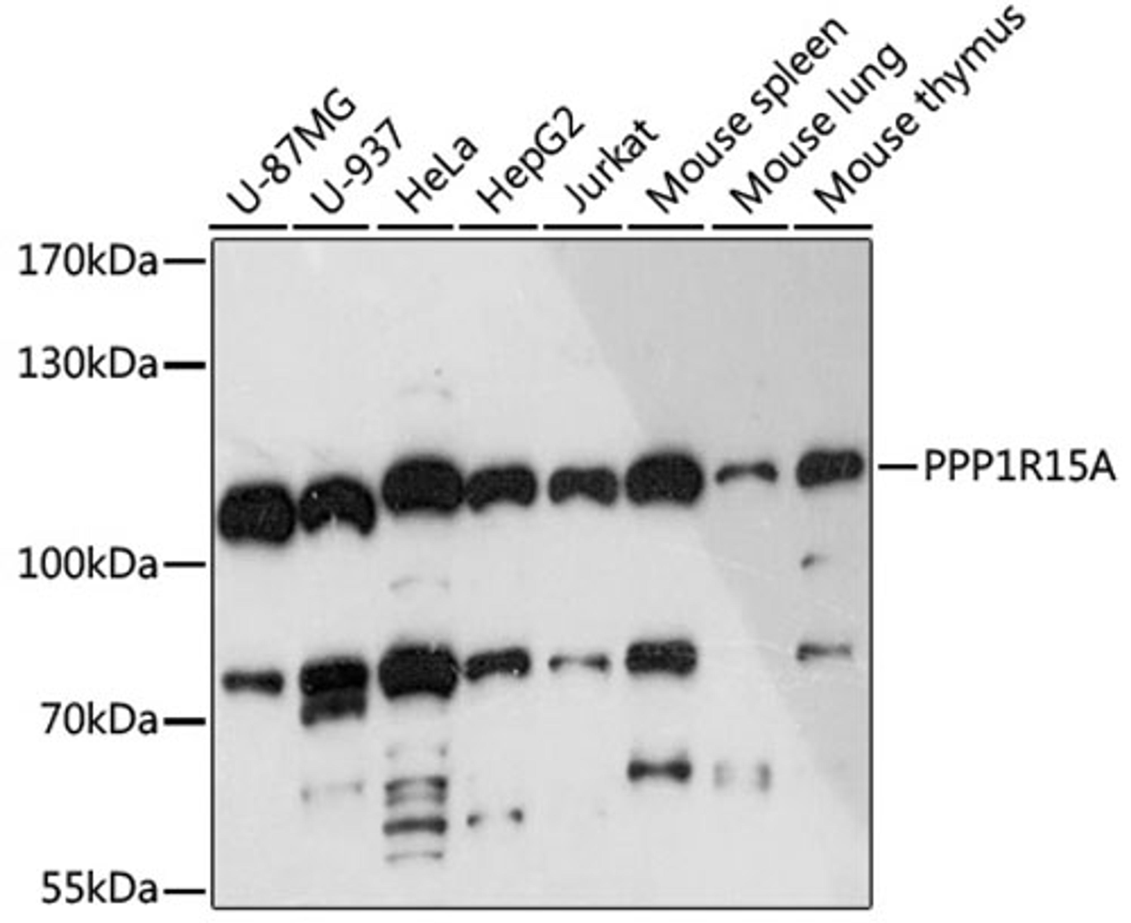 Western blot - PPP1R15A antibody (A16260)