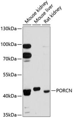 Western blot - PORCN antibody (A12250)