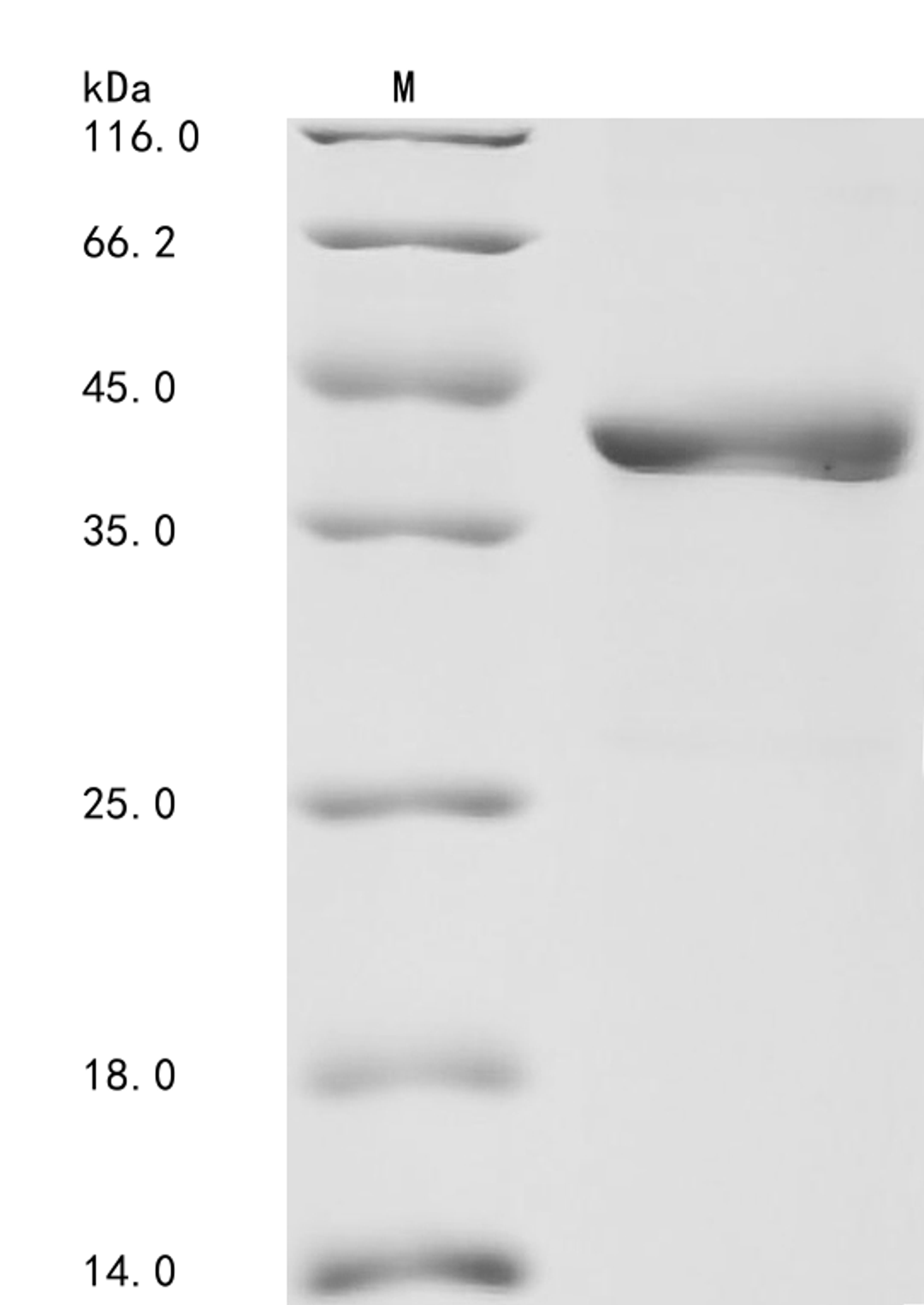 (Tris-Glycine gel) Discontinuous SDS-PAGE (reduced) with 5% enrichment gel and 15% separation gel.