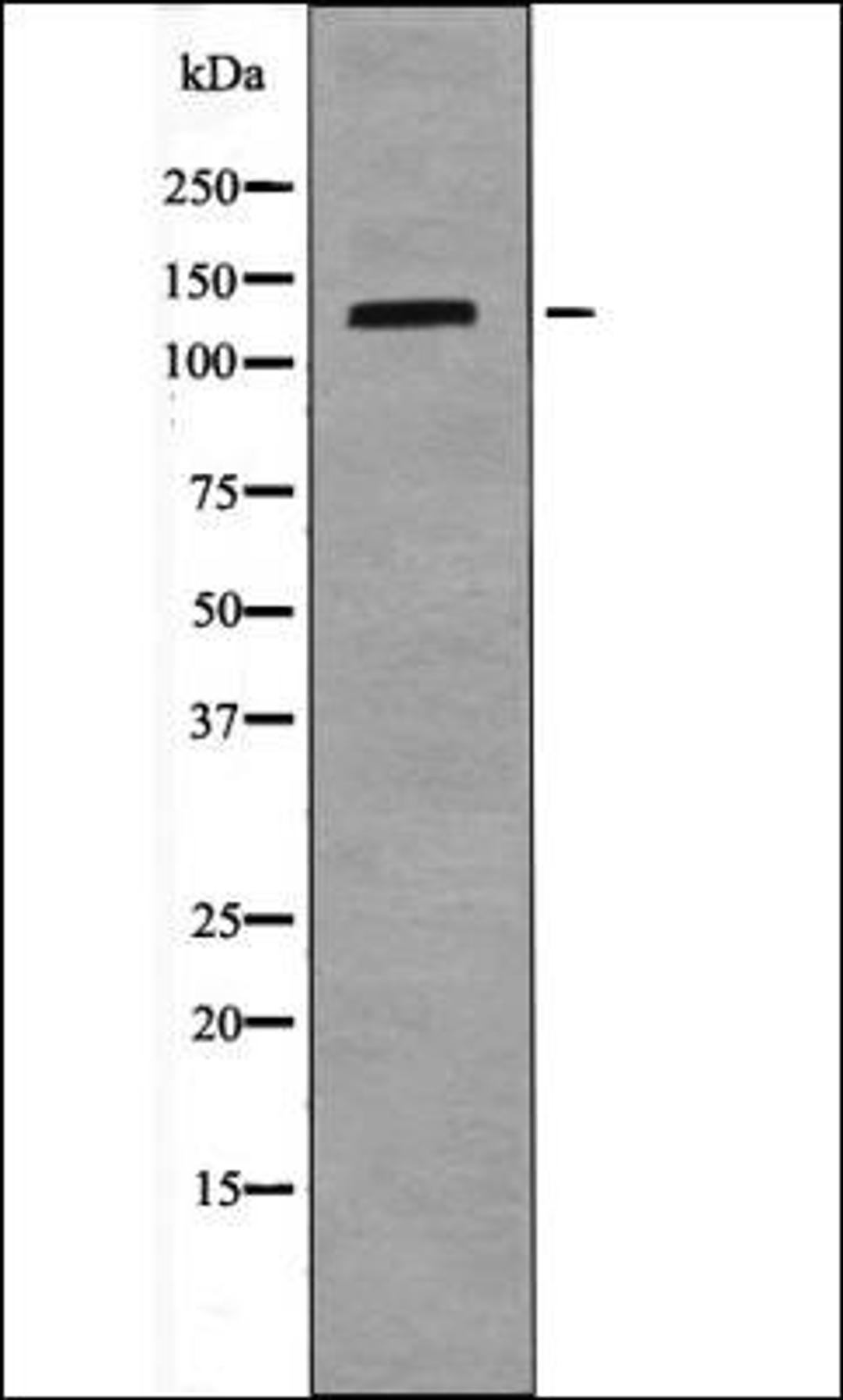 Western blot analysis of LOVO whole cell lysates using TIE1 -Phospho-Tyr1117- antibody