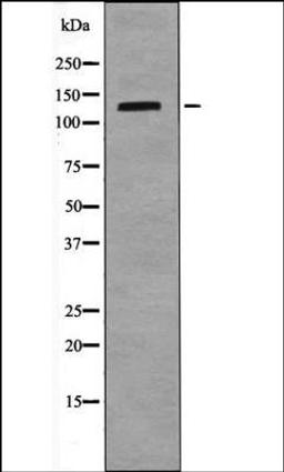 Western blot analysis of LOVO whole cell lysates using TIE1 -Phospho-Tyr1117- antibody