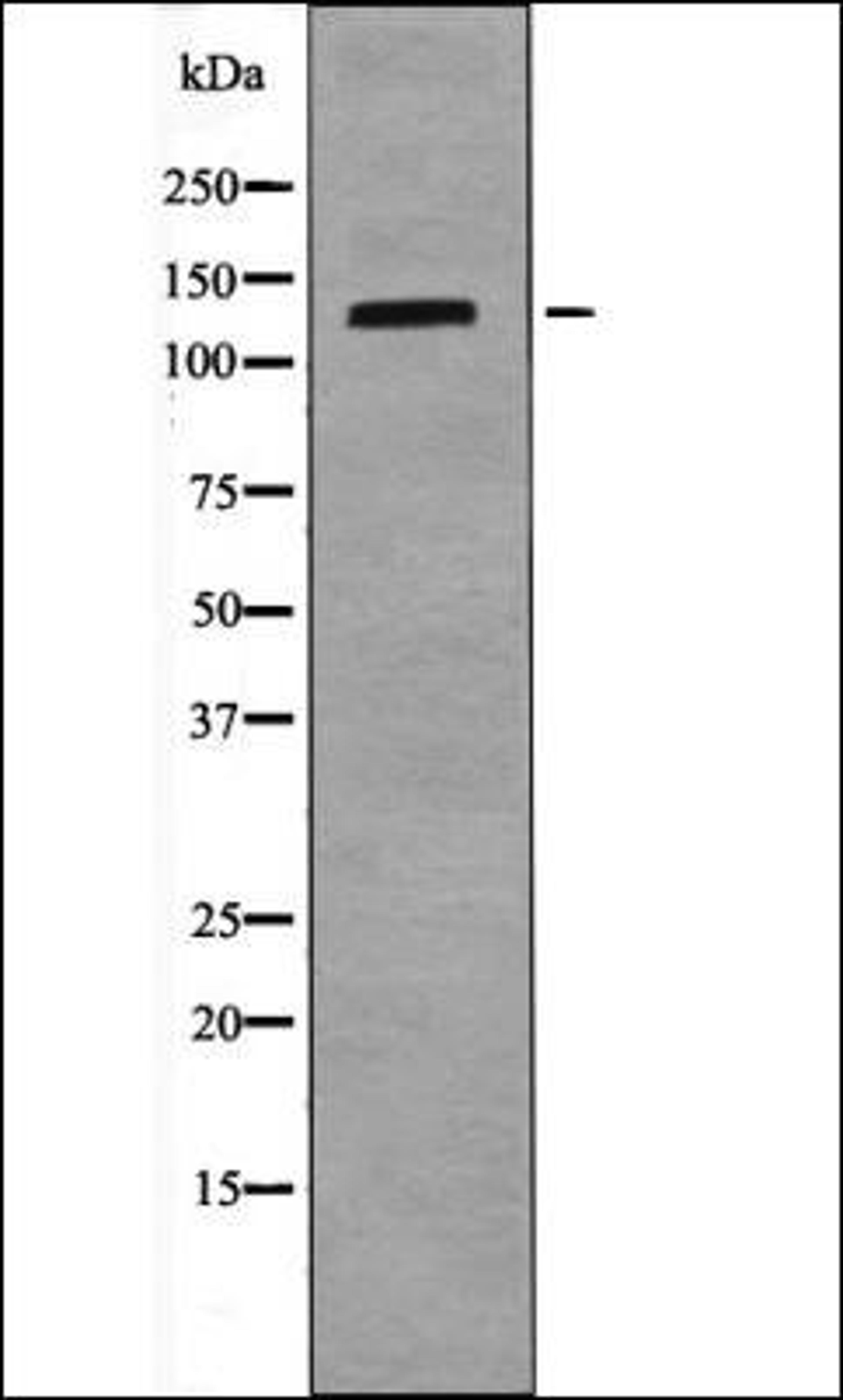 Western blot analysis of LOVO whole cell lysates using TIE1 -Phospho-Tyr1117- antibody