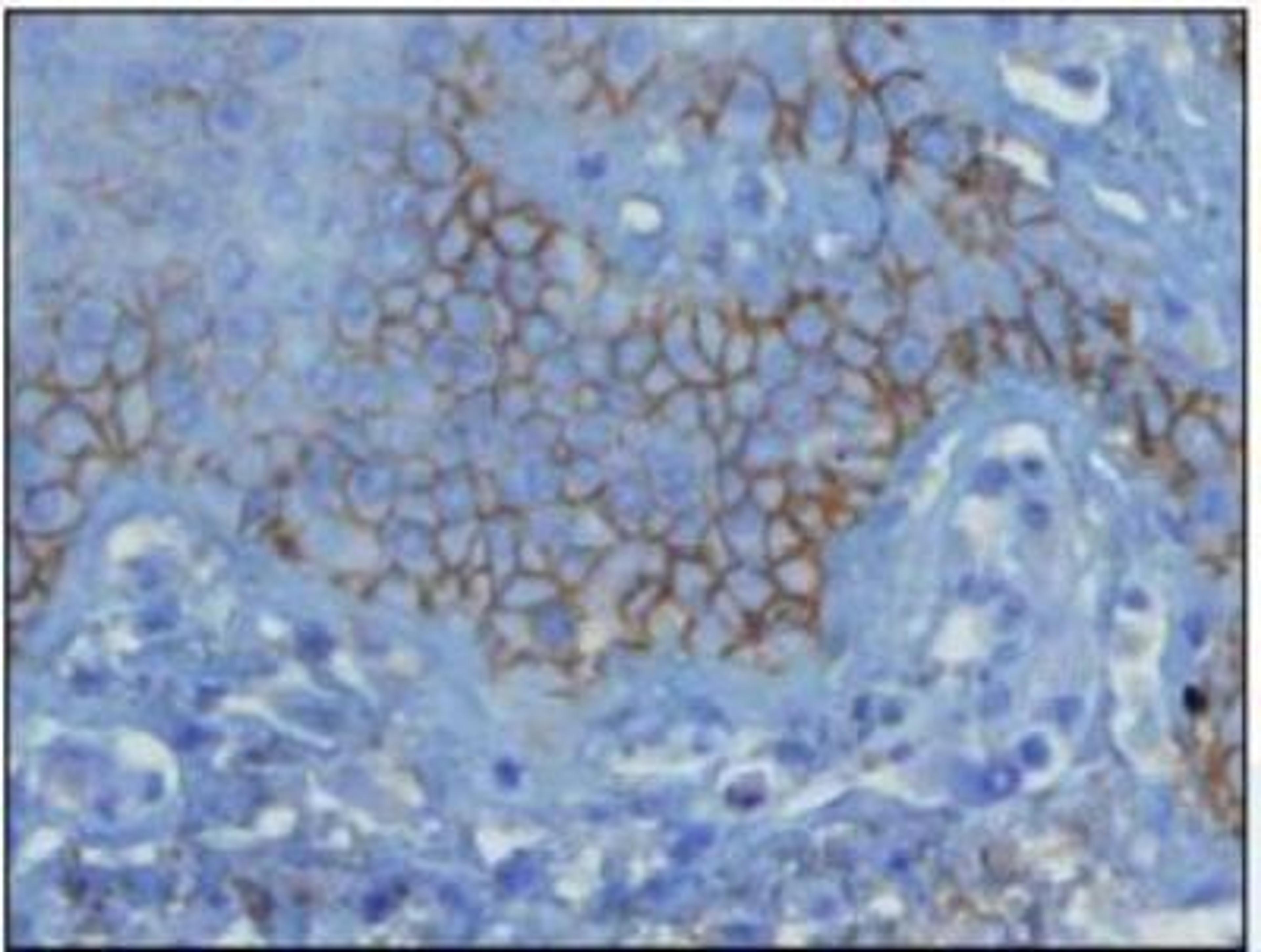 Immunohistochemistry-Paraffin: Complement C3d Antibody (E28-P) [NBP1-79074] - Formalin-fixed and paraffin-embedded human skin biopsy (4 um) from lesion of the early pemphigus vulgaris (without blister formation), stained with anti-C3d complement antibody shows strong positive intraepidermal intercellular immunostaining.