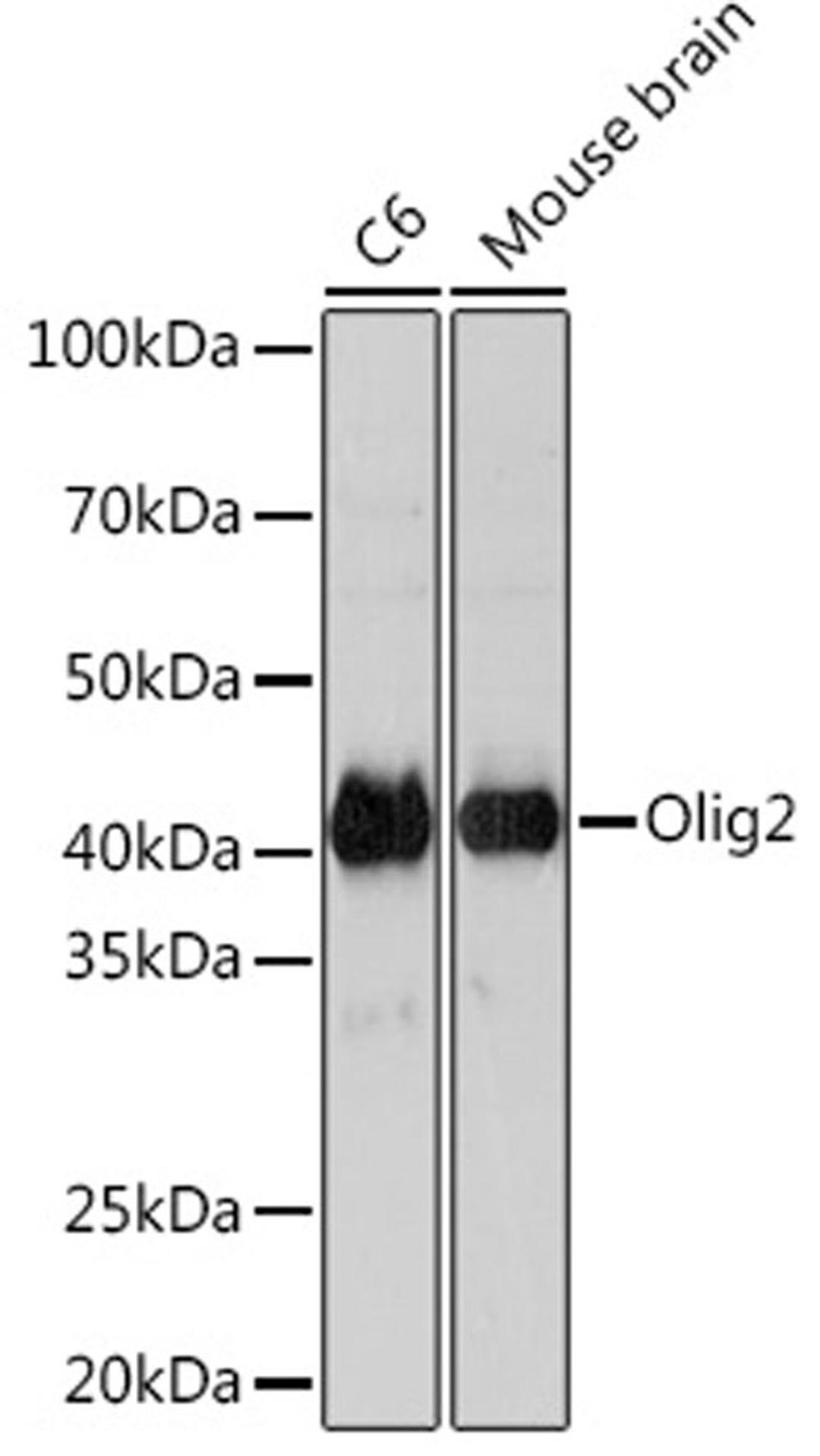 Western blot - Olig2 Rabbit mAb (A4555)