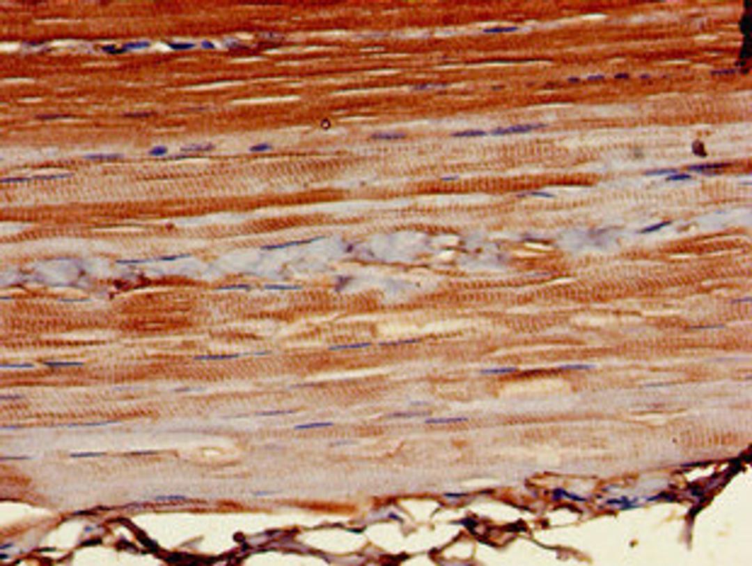 Immunohistochemistry of paraffin-embedded human skeletal muscle tissue using CSB-PA868326LA01HU at dilution of 1:100