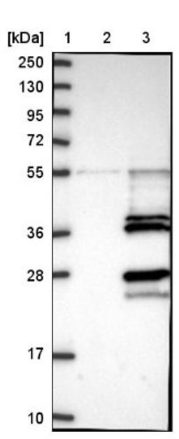 Western Blot: LYSMD4 Antibody [NBP1-83511] - Lane 1: Marker [kDa] 250, 130, 95, 72, 55, 36, 28, 17, 10<br/>Lane 2: Negative control (vector only transfected HEK293T lysate)<br/>Lane 3: Over-expression lysate (Co-expressed with a C-terminal myc-DDK tag (~3.1 kDa) in mammalian HEK293T cells, LY407487)