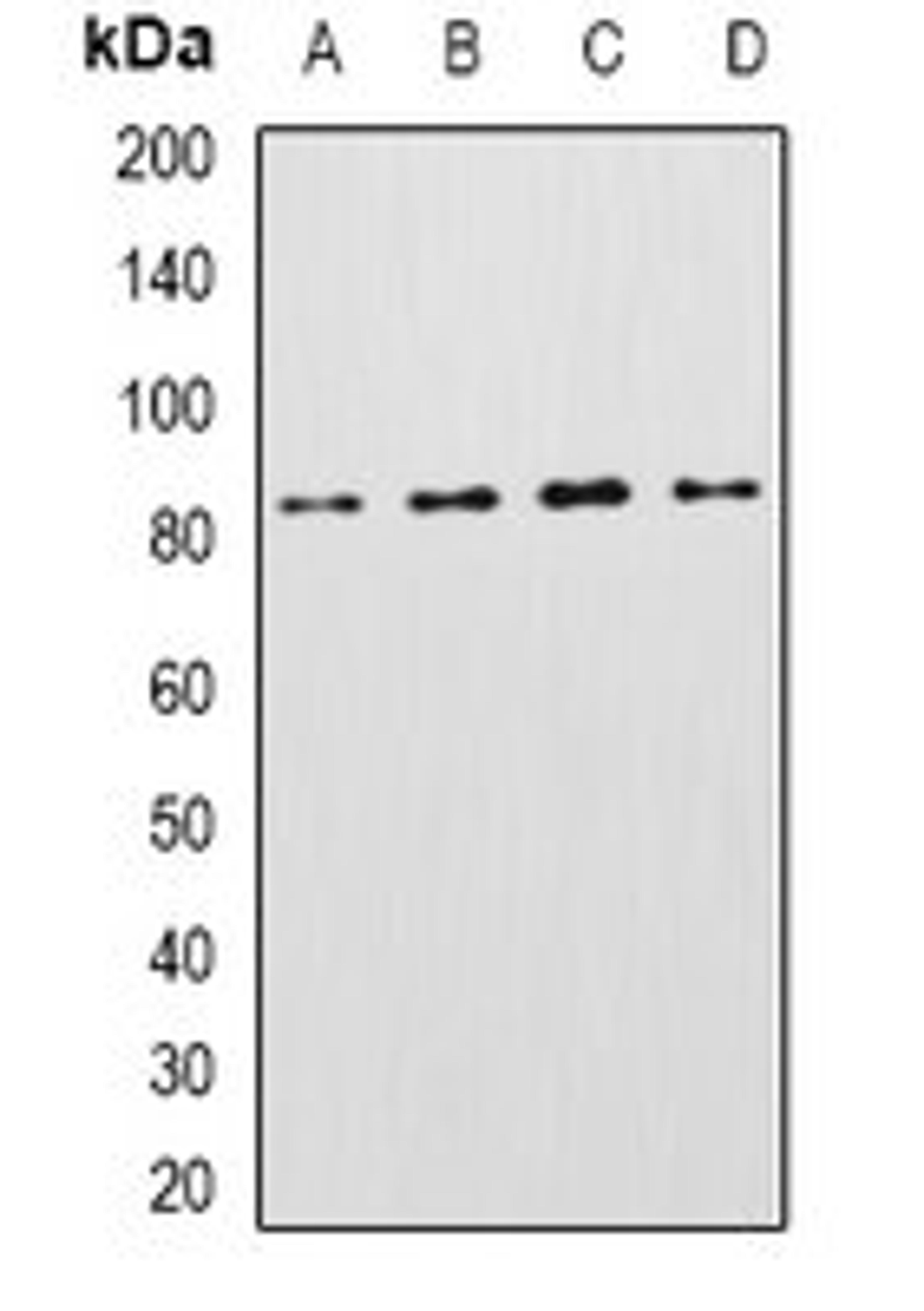 Western blot analysis of Raji (Lane1), mouse heart (Lane2), mouse livere (Lane3), rat brain (Lane4) whole cell lysates using KCNN3 antibody