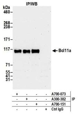 Detection of human Bcl11a by western blot of immunoprecipitates.