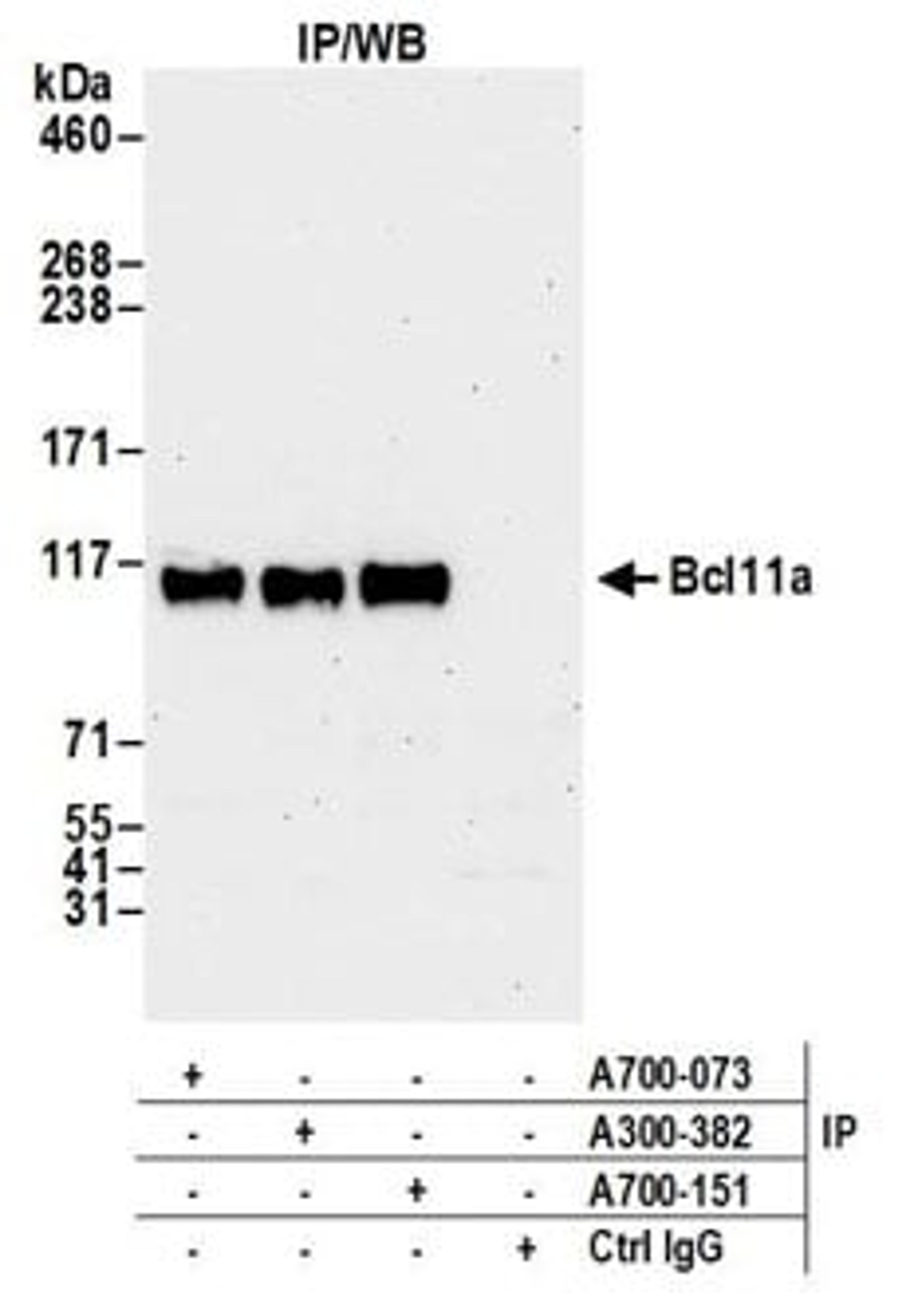 Detection of human Bcl11a by western blot of immunoprecipitates.