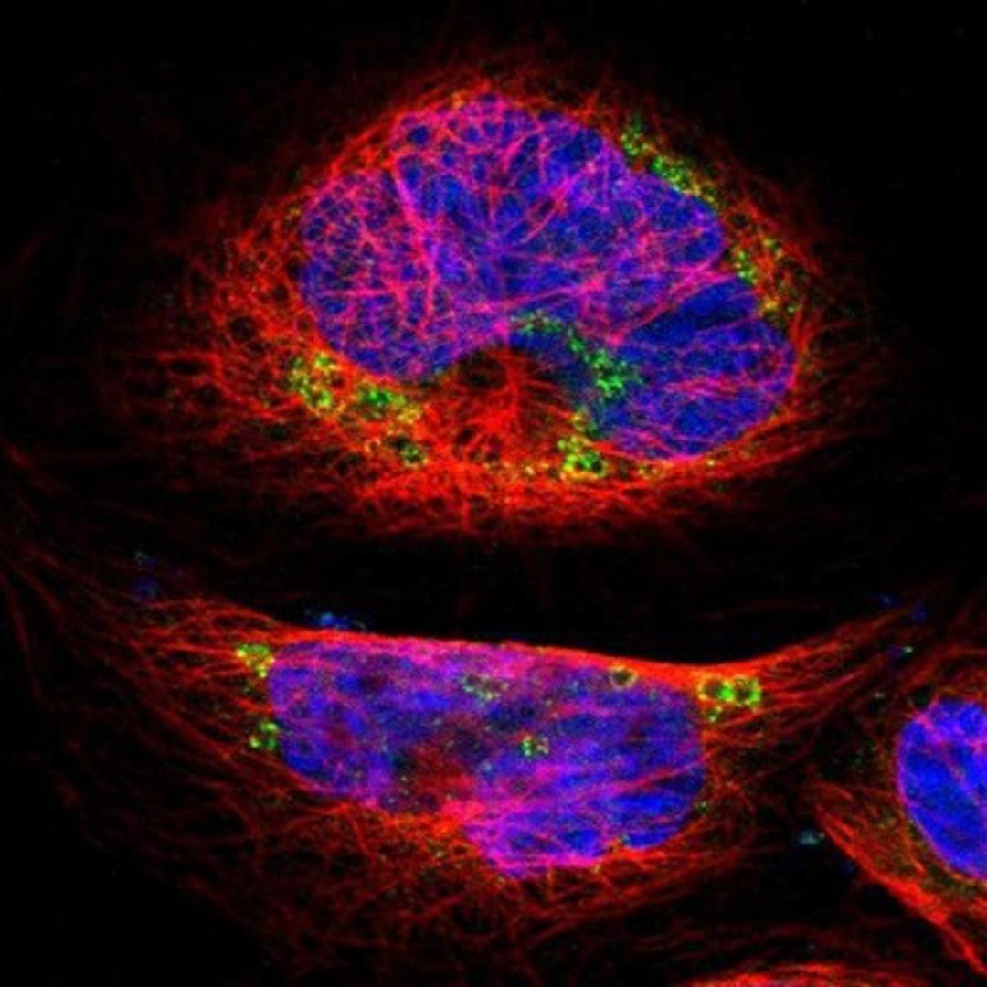 Immunocytochemistry/Immunofluorescence: NCLN Antibody [NBP1-81002] Staining of human cell line A-431 shows positivity in endoplasmic reticulum & vesicles.