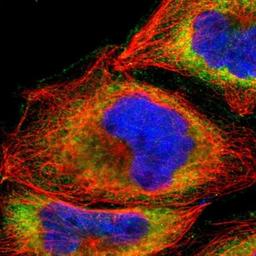 Immunocytochemistry/Immunofluorescence: ADAMTSL4 Antibody [NBP1-84185] - Staining of human cell line A-431 shows positivity in plasma membrane & cytoplasm.