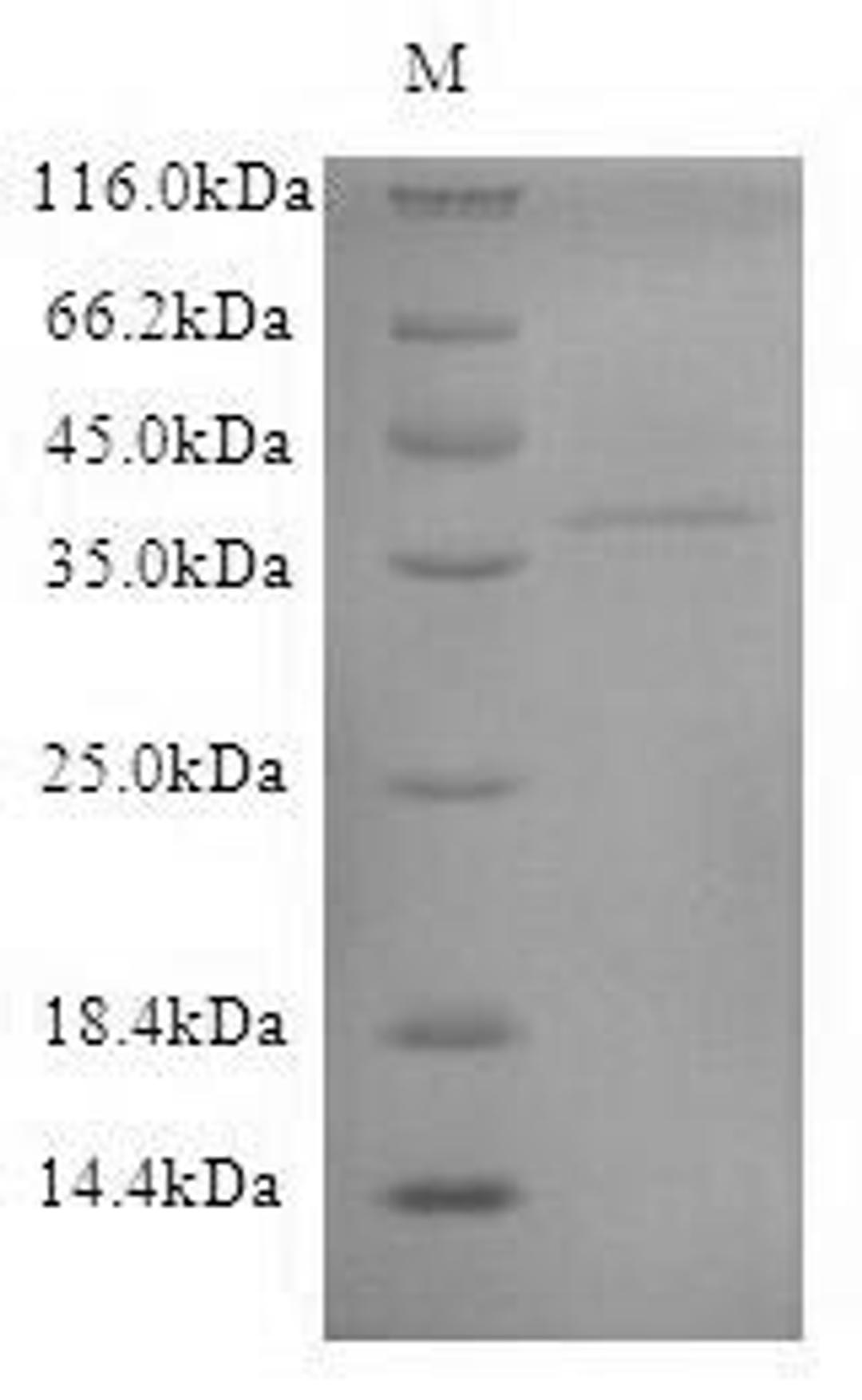 (Tris-Glycine gel) Discontinuous SDS-PAGE (reduced) with 5% enrichment gel and 15% separation gel.