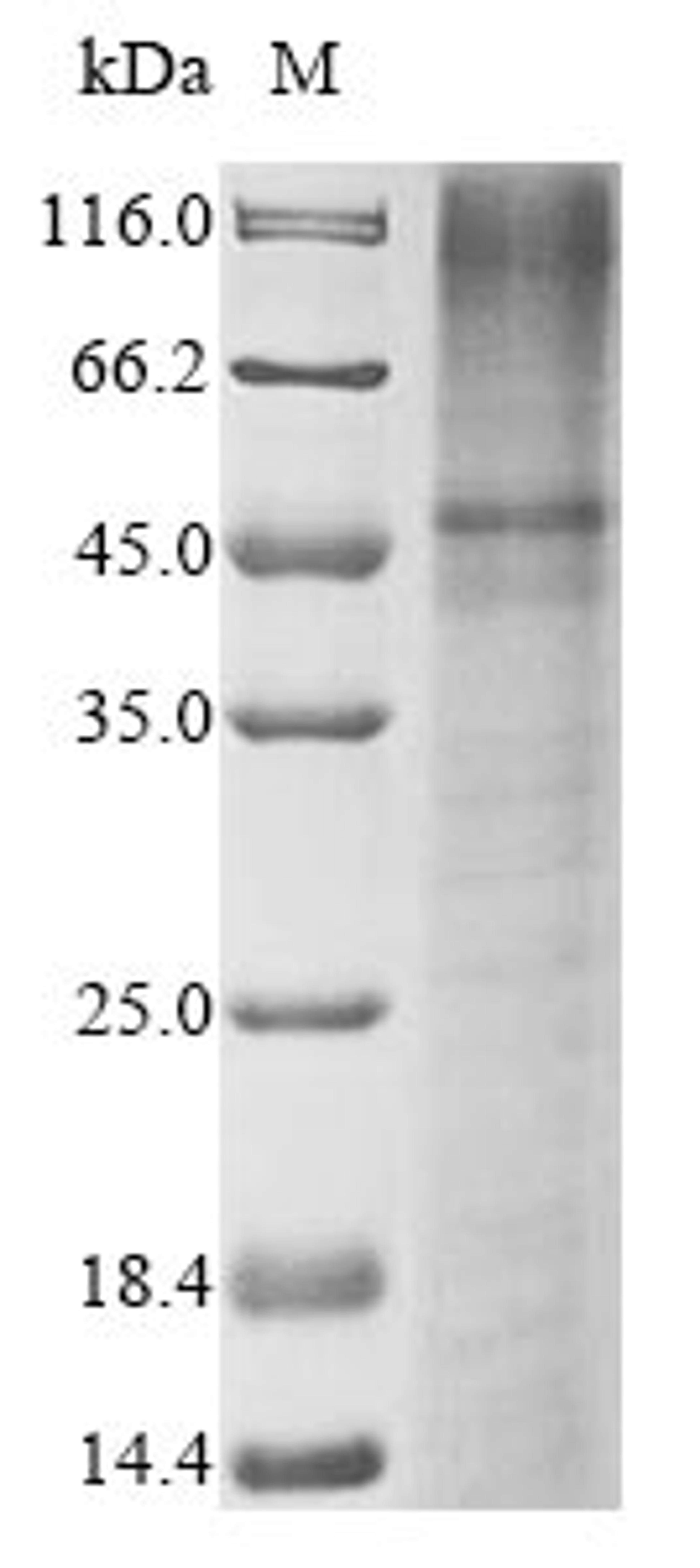 (Tris-Glycine gel) Discontinuous SDS-PAGE (reduced) with 5% enrichment gel and 15% separation gel.