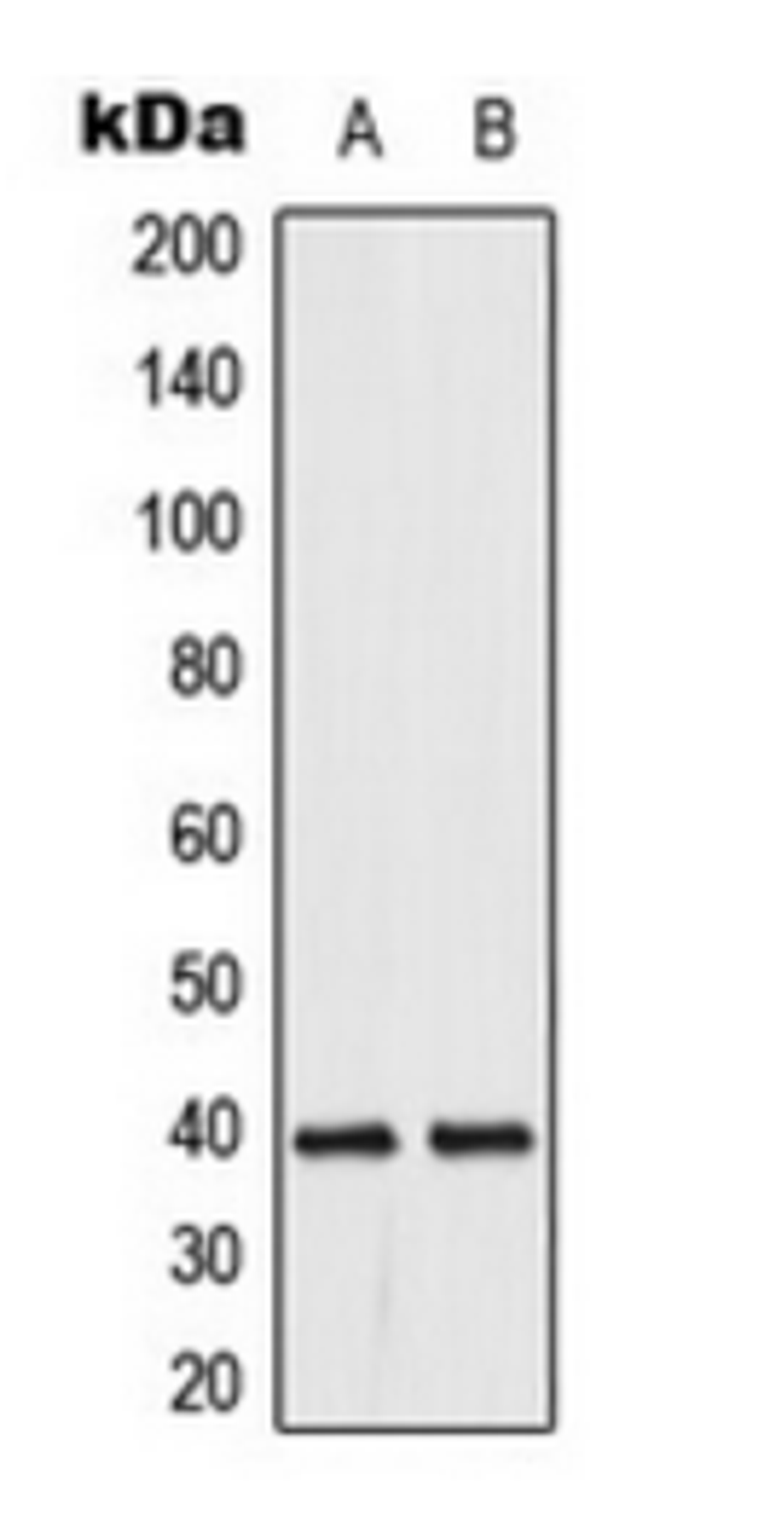 Western blot analysis of HeLa (Lane 1), Jurkat (Lane 2) whole cell lysates using DUSP1/4 antibody