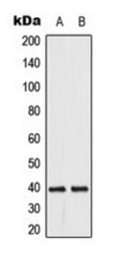 Western blot analysis of HeLa (Lane 1), Jurkat (Lane 2) whole cell lysates using DUSP1/4 antibody