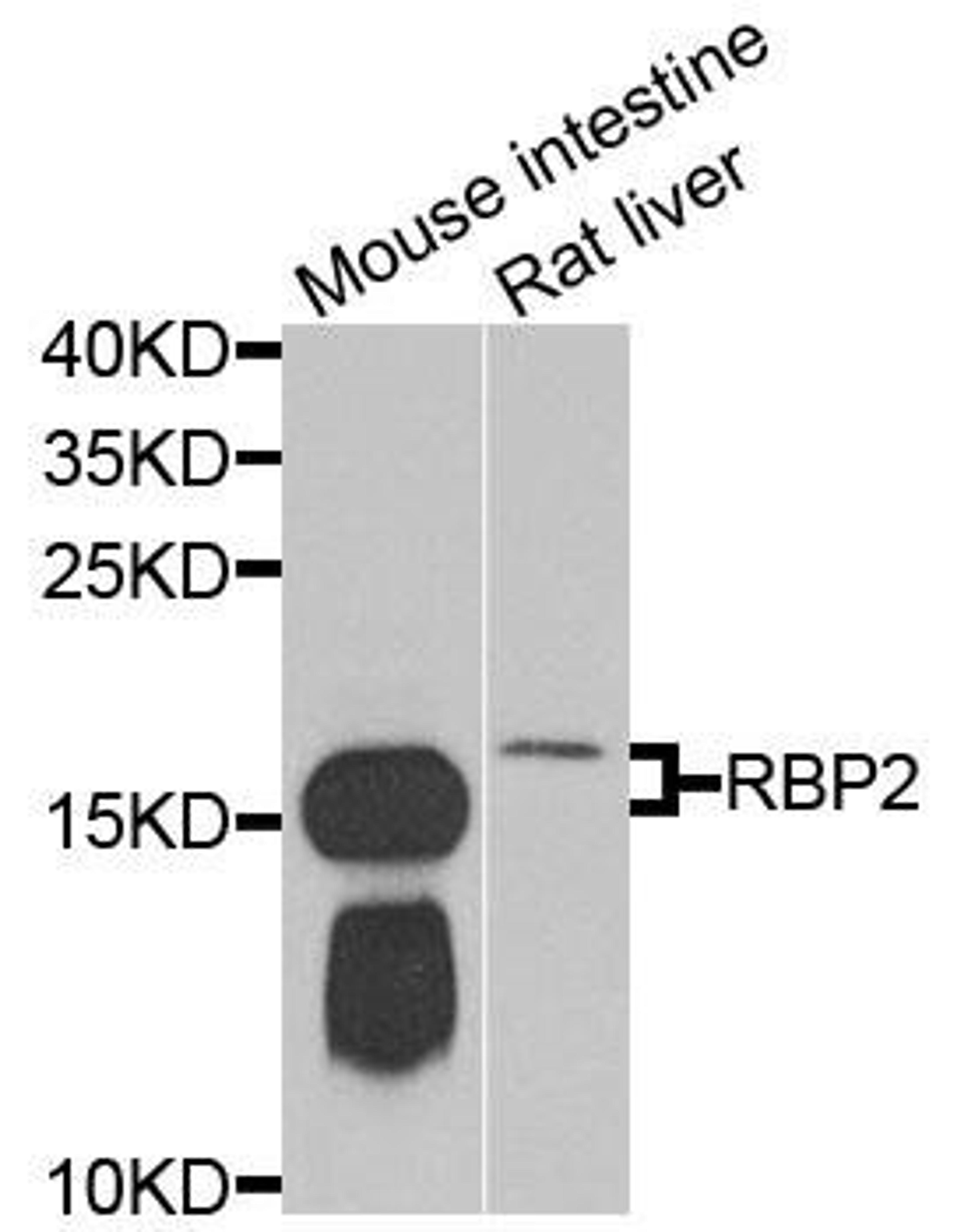 Western blot analysis of extracts of various cells using RBP2 antibody