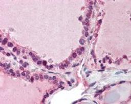 Immunohistochemistry staining of POLS in thyroid tissue using POLS Antibody.