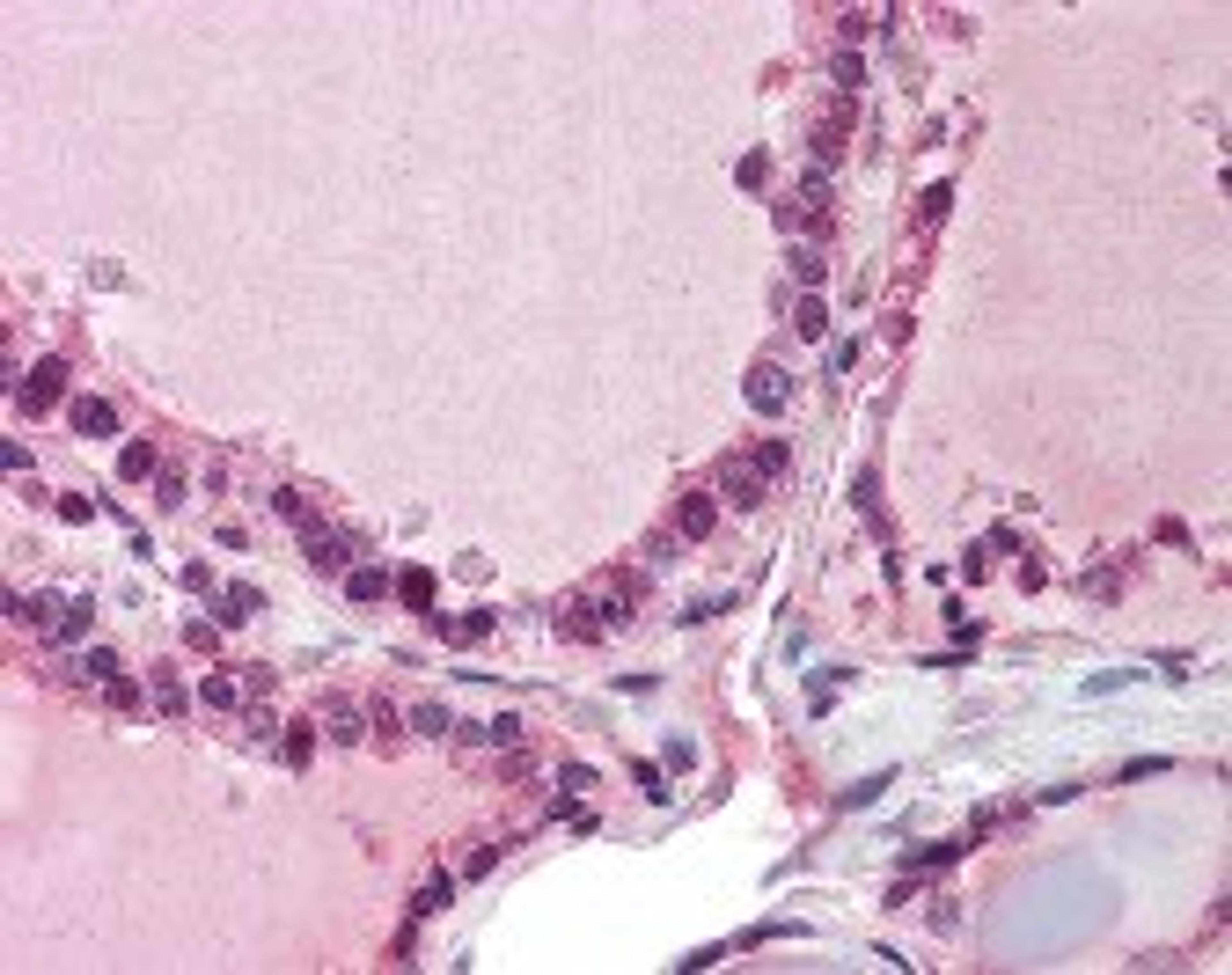 Immunohistochemistry staining of POLS in thyroid tissue using POLS Antibody.