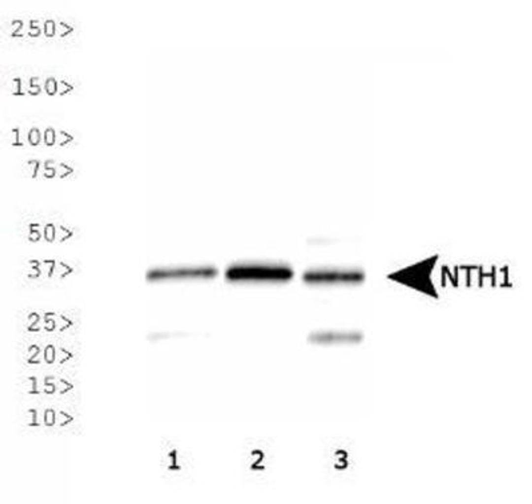 Western Blot: NTH1 Antibody [NB100-108] - Analysis of NTH1 expression in 1) HeLa, 2) A-431, 3) MCF7 whole cell lysates.