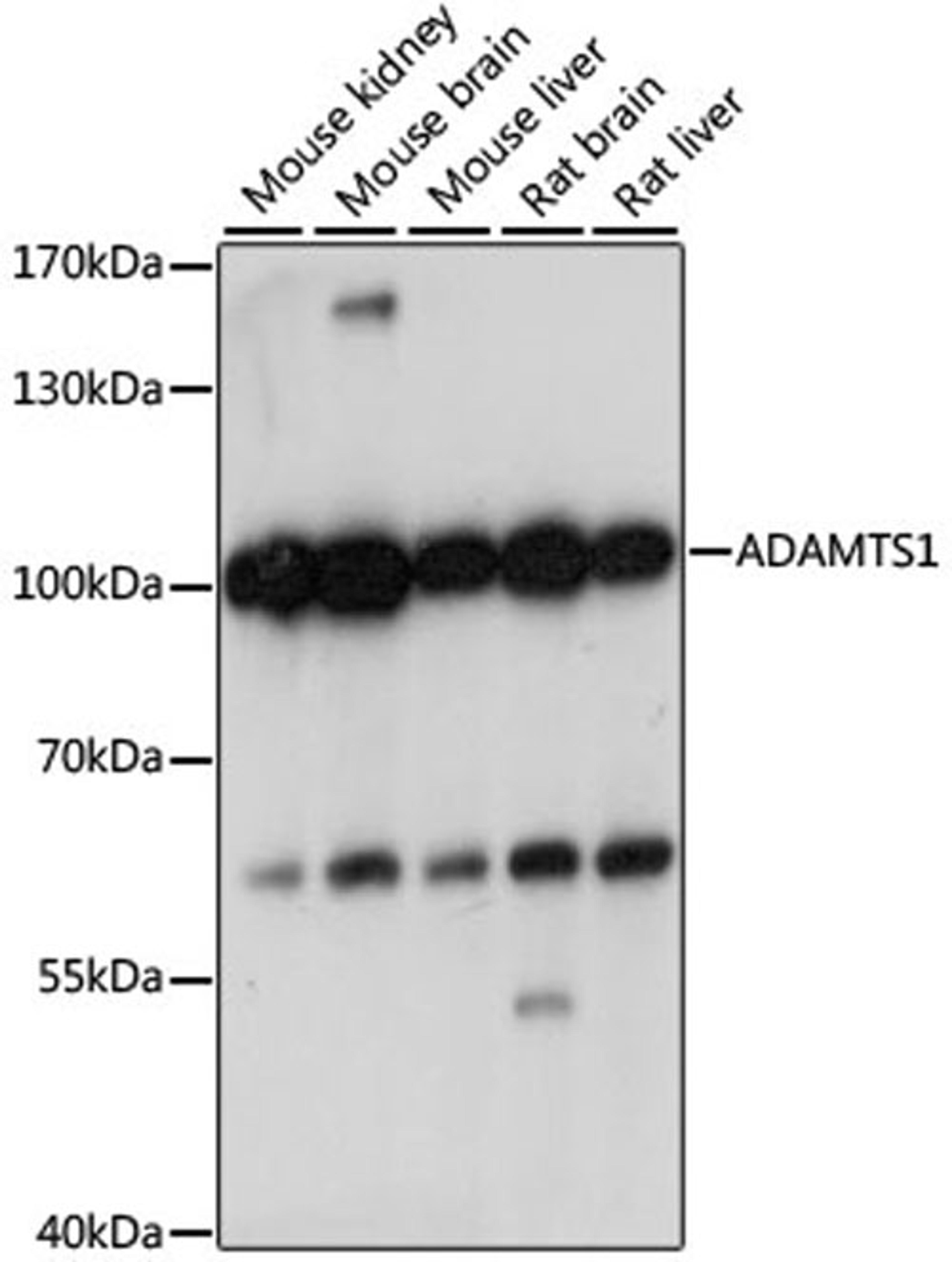 Western blot - ADAMTS1 antibody (A15356)