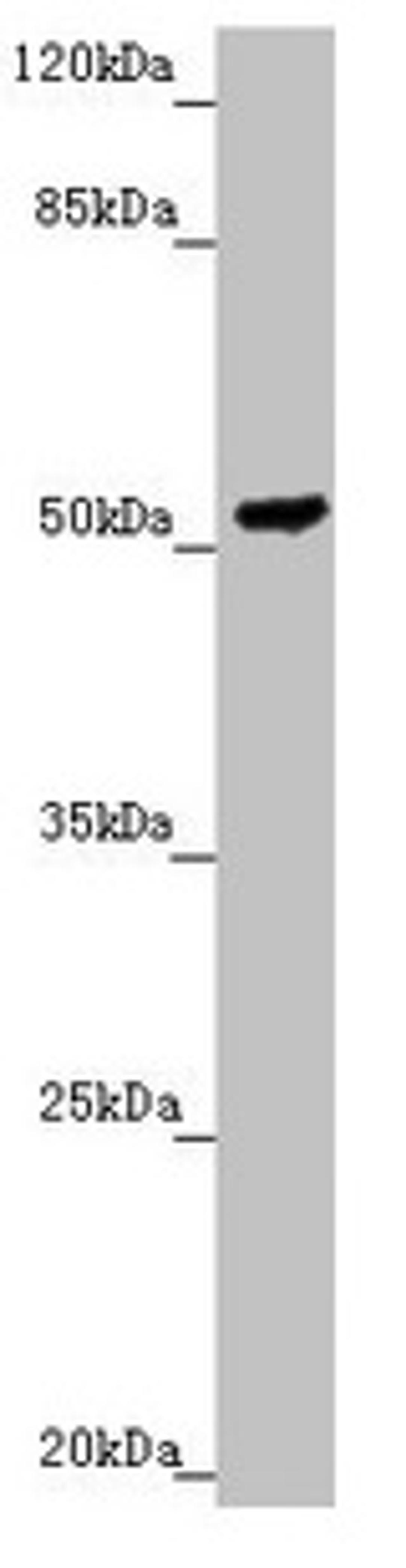 Western blot. All lanes: PMPCB antibody at 2.3µg/ml + HepG2 whole cell lysate. Secondary. Goat polyclonal to rabbit IgG at 1/10000 dilution. Predicted band size: 55 kDa. Observed band size: 55 kDa